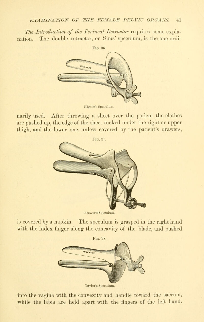 The Introduction of the Perineal Retractor requires some expla- nation. The double retractor, or Sims' speculum, is the one ordi- FiG. 36. Higbee's Speculum. narily used. After throwing a sheet over the patient the clothes are pushed up, the edge of the sheet tucked under the right or upper thigh, and the lower one, unless covered by the patient's drawers, Fig. 37 Brewer's Speculum. is covered by a napkin. The speculum is grasped in the right hand with the index finger along the concavity of the blade, and pushed Taylor's Specula into the vagina with the convexity and handle toward the sacrum, while the labia are held apart with the fingers of the left hand.