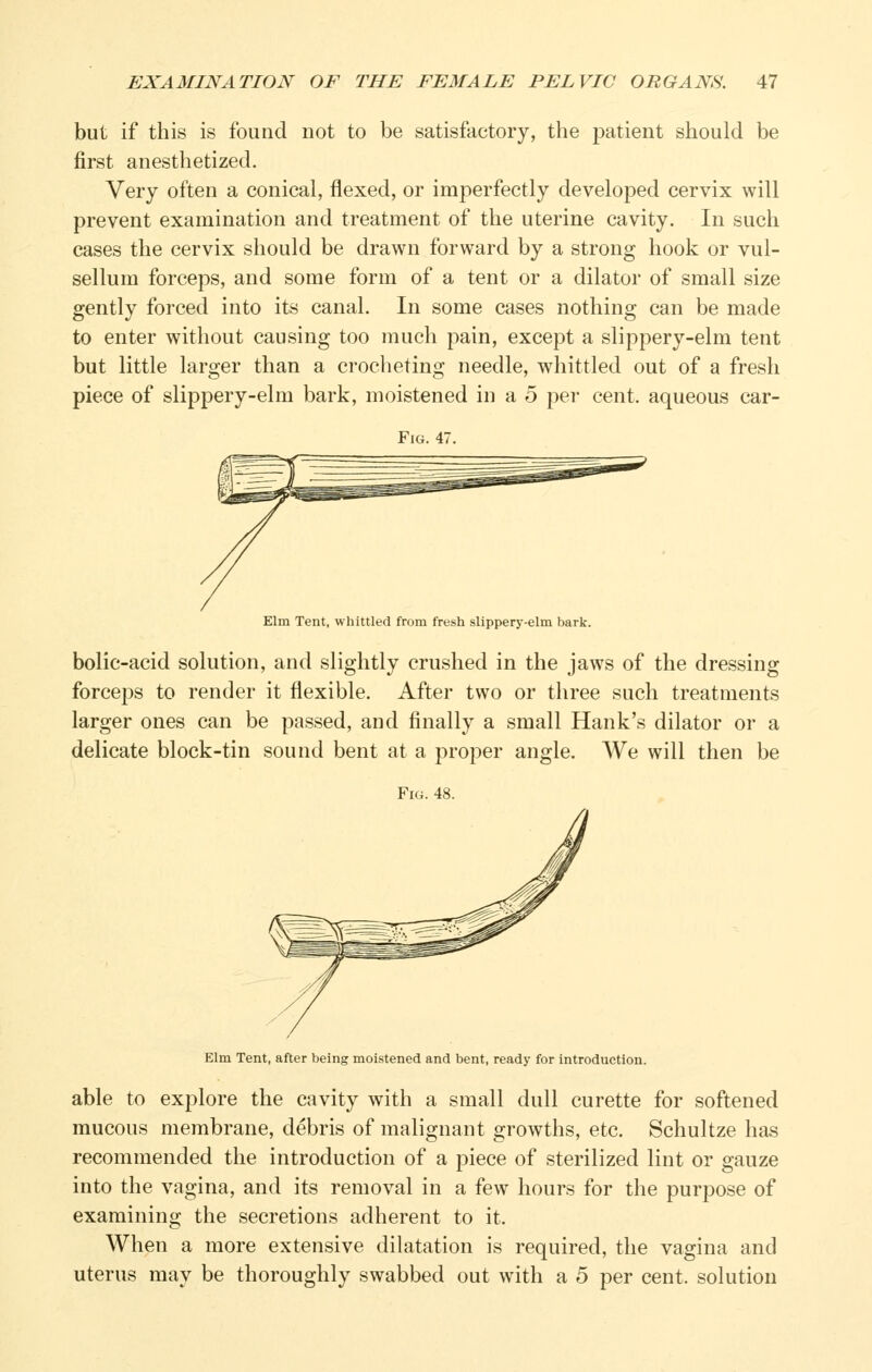 but if this is found not to be satisfactory, the patient should be first anesthetized. Very often a conical, flexed, or imperfectly developed cervix will prevent examination and treatment of the uterine cavity. In such cases the cervix should be drawn forward by a strong hook or vul- sellum forceps, and some form of a tent or a dilator of small size gently forced into its canal. In some cases nothing can be made to enter without causing too much pain, except a slippery-elm tent but little larger than a crocheting needle, whittled out of a fresh piece of slippery-elm bark, moistened in a 5 per cent, aqueous car- FiG. 47. Elm Tent, whittled from fresh slippery-elm bark. bolic-acid solution, and slightly crushed in the jaws of the dressing forceps to render it flexible. After two or three such treatments larger ones can be passed, and finally a small Hank's dilator or a delicate block-tin sound bent at a proper angle. We will then be Fig. 48. Elm Tent, after being moistened and bent, ready for introduction. able to explore the cavity with a small dull curette for softened mucous membrane, debris of malignant growths, etc. Schultze has recommended the introduction of a piece of sterilized lint or gauze into the vagina, and its removal in a few hours for the purpose of examining the secretions adherent to it. When a more extensive dilatation is required, the vagina and uterus may be thoroughly swabbed out with a 5 per cent, solution