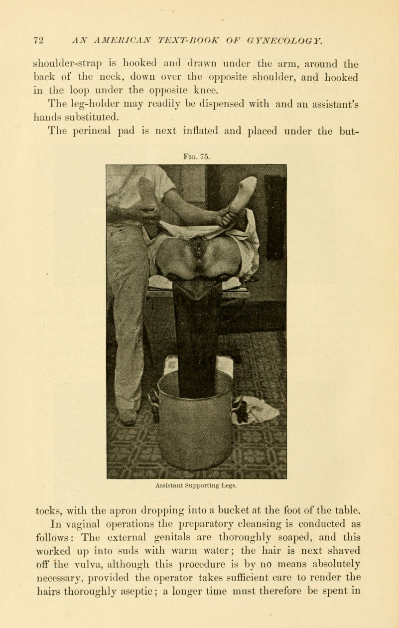 shoulder-strap is hooked and drawn under the arm, around the back of the neck, down over the opposite shoulder, and hooked in the loop under the opposite knee. The leg-holder may readily be dispensed with and an assistant's hands substituted. The perineal pad is next inflated and placed under the but- FiG. 75. Assistant Supporting Legs. tocks, with the apron dropping into a bucket at the foot of the table. In vaginal operations the preparatory cleansing is conducted as follows: The external genitals are thoroughly soaped, and this worked up into suds with warm water; the hair is next shaved off 'the vulva, although this procedure is by no means absolutely necessary, provided the operator takes sufficient care to render the hairs thoroughly aseptic; a longer time must therefore be spent in