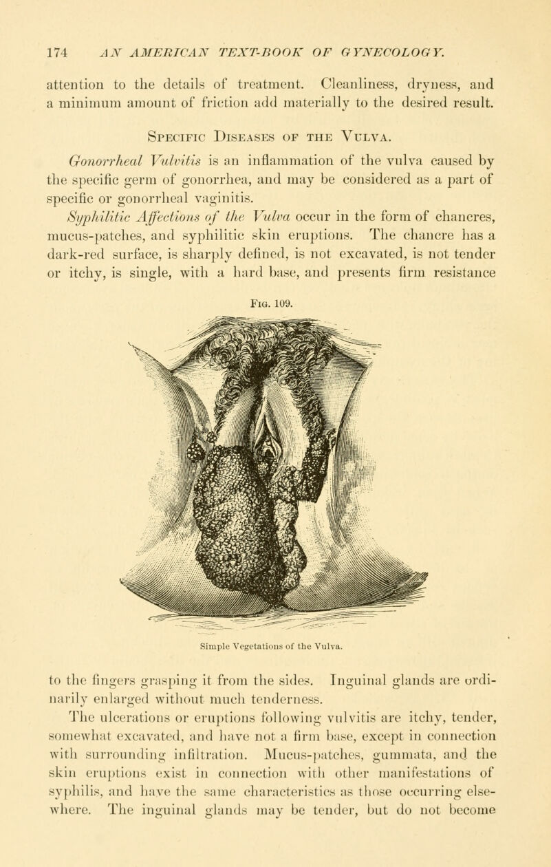 attention to the details of treatment. Cleanliness, dryness, and a minimum amount of friction add materially to the desired result. Specific Diseases of the Vulva. Gonorrheal Vulvitis is an inflammation of the vulva caused by the specific germ of gonorrhea, and may be considered as a part of specific or gonorrheal vaginitis. Syijhiliiic Ajfections of the Vulva occur in the form of chancres, mucus-patches, and syphilitic skin eruptions. The chancre has a dark-red surface, is sharply defined, is not excavated, is not tender or itchy, is single, with a hard base, and presents firm resistance Fig. 109. Simple Vegetations of the Vulva. to the fingers gras[)ing it from the sides. Inguinal glands are ordi- narily enlarged without much tenderness. The ulcerations or eruptions following vulvitis are itchy, tender, somewhat excavated, and have not a firm base, except in connection with surrounding infiltration. Mucus-]iatches, gummata, and the skin eruptions exist in connection with other manifestations of syphilis, and have the same characteristics as those occurring else- where. The inguinal glands may be tender, but do not become