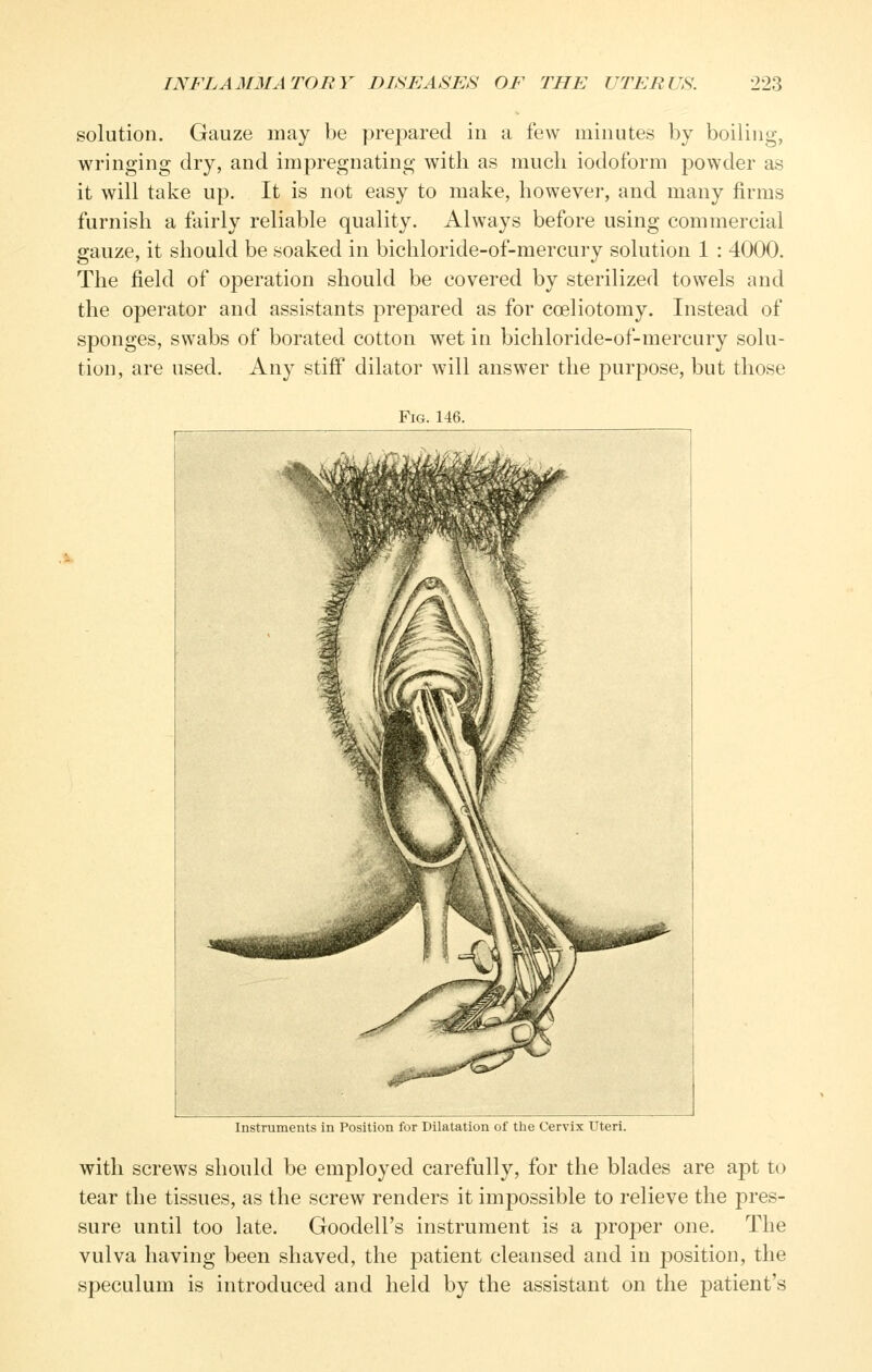 solution. Gauze may be prepared in a few minutes by boiling, wringing dry, and impregnating with as much iodoform powder as it will take up. It is not easy to make, however, and many firms furnish a fairly reliable quality. Always before using commercial gauze, it should be soaked in bichloride-of-mercury solution 1 : 4000. The field of operation should be covered by sterilized towels and the operator and assistants prepared as for coeliotomy. Instead of sponges, swabs of borated cotton wet in bichloride-of-mercury solu- tion, are used. Any stiff dilator will answer the purpose, but those Fig. 146. Instruments in Position for Dilatation of the Cervix Uteri. with screws should be employed carefully, for the blades are apt to tear the tissues, as the screw renders it impossible to relieve the pres- sure until too late. Goodell's instrument is a proper one. The vulva having been shaved, the patient cleansed and in position, the speculum is introduced and held by the assistant on the patient's