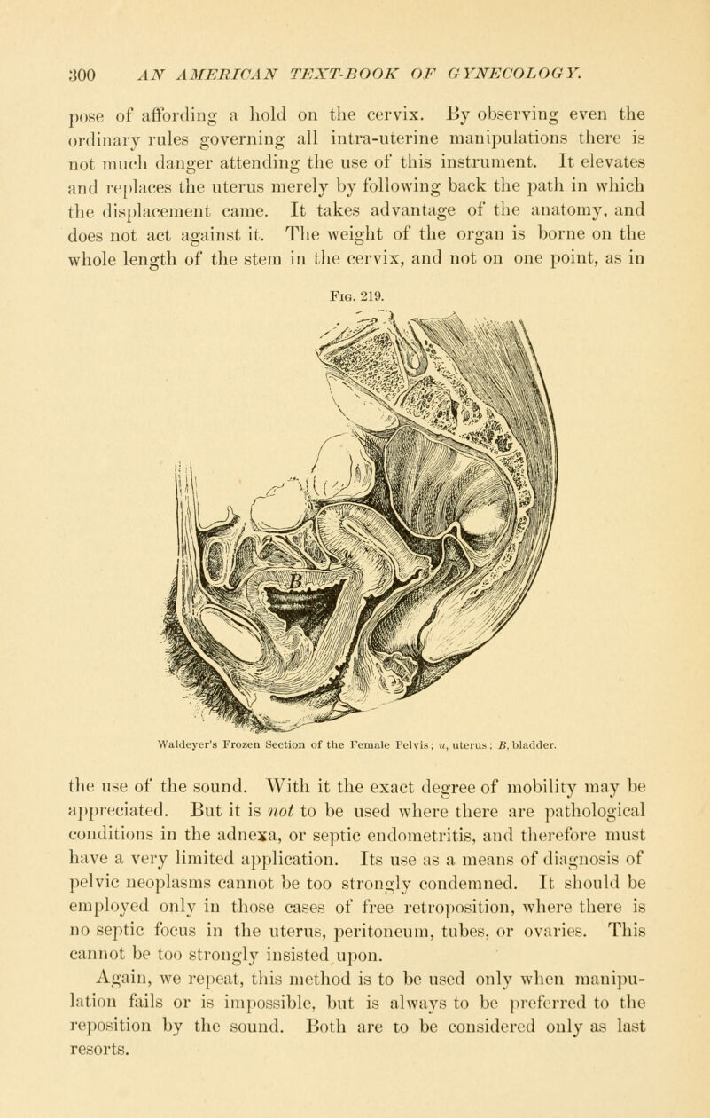 pose of affording a hold on the cervix. By observing even the ordinary rules governing all intra-uterine manipulations there is not much danger attending the use of this instrument. It elevates and replaces the uterus merely by following back the path in which the displacement came. It takes advantage of the anatomy, and does not act against it. The weight of the organ is borne on the whole length of the stem in the cervix, and not on one point, as in Fig. 219. Waldeyer's Frozen Section of the Female Pelvis; «, uterus; B,bladder. the use of the sound. With it the exact degree of mobility may be appreciated. But it is not to be used where there are pathological conditions in the adnexa, or septic endometritis, and therefore must have a very limited application. Its use as a means of diagnosis of pelvic neoplasms cannot be too strongly condemned. It should be employed only in those cases of free retro])Osition, where there is no septic focus in the uterus, peritoneum, tubes, or ovaries. This cannot be too strongly insisted upon. Again, we repeat, this method is to be used only when manijni- lation fails or is impossible, but is always to be ]ireferred to the reposition by the sound. Both are to be considered only as last resorts.