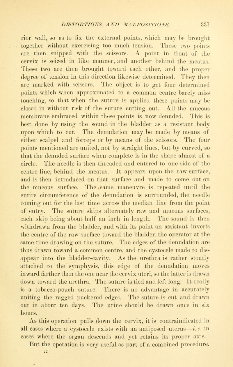 rior wall, so as to fix the external points, which may be brought together without exercising too much tension. These two points are then snipped with the scissors. A point in front of the cervix is seized in like manner, and another behind the meatus. These two are then brought toward each other, and the proper degree of tension in this direction likewise determined. They then are marked with scissors. The object is to get four determined points which when approximated to a common centre barely miss touching, so that when the suture is applied these points may be closed in without risk of the suture cutting out. All the mucous membrane embraced within these points is now denuded. This is best done by using the sound in the bladder as a resistant body upon which to cut. The denudation may be made by means of eithei* scalpel and forceps or by means of the scissors. The four points mentioned are united, not by straight lines, but by curved, so that the denuded surface when complete is in the shape almost of a circle. The needle is then threaded and entered to one side of the centre line, behind the meatus. It appears upon the raw surface, and is then introduced on that surface and made to come out on the mucous surface. The ^,same maneuvre is repeated until the entire circumference of the denudation is surrounded, the needle coming out for the last time across the median line from the point of entry. The suture skips alternately raw and mucous surfaces, each skip being about half an inch in length. The sound is then withdrawn from the bladder, and with its point an assistant inverts the centre of the raw surface toward the bladder, the operator at the same time drawing on the suture. The edges of the denudation are thus drawn toward a common centre, and the cystocele made to dis- appear into the bladder-cavity. As the urethra is rather stoutly attached to the symphysis, this edge of the denudation moves inward farther than the one near the cervix uteri, so the latter is drawn down toward the urethra. The suture is tied and left long. It really is a tobacco-pouch suture. There is no advantage in accurately uniting the ragged puckered edges. The suture is cut and drawn out in about ten days. The urine should be drawn once in six hours. As this operation pulls down the cervix, it is contraindicated in all cases where a cystocele exists with an antiposed uterus—i. e. in cases where the organ descends and yet retains its proper axis. But the operation is very useful as part of a combined procedure.