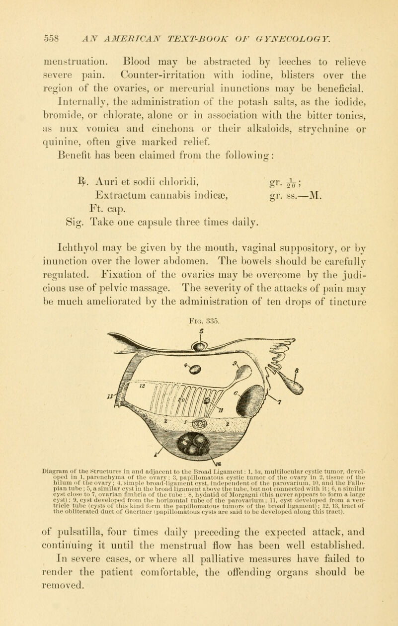 menstruation. Blood may be abstracted by leeches to relieve severe pain. Counter-irritation with iodine, blisters over the region of the ovaries, or mercurial inunctions may be beneficial. Internally, the administration of the potash salts, as the iodide, bromide, or chlorate, alone or in association with the bitter tonics, as nux vomica and cinchona or their alkaloids, strychnine or quinine, often give marked relief Benefit has been claimed from the followino-: I^. Auri et sodii chloridi, Extractum cannabis indicse. Ft. cap. Sig. Take one capsule three times daily. 2;r. ss.—M. Ichthyol may be given by the mouth, vaginal suppository, or by inunction over the lower abdomen. The bowels should be carefully regulated. Fixation of the ovaries may be overcome by the judi- cious use of pelvic massage. The severity of the attacks of pain may be much ameliorated by the administration of ten drops of tincture Diagram of the Structures in and adjaoent to tlie Broad Ligament: 1, ^a, multilocular cystic tumor, dovol- oi)ed in 1, parenchyma of the oVarv; , iia|iilloinatii\i's cvslic tumor of the ovarv in '_', tiss\ie of tlie hilum of the ovary; 1, siiniiU' broad-liKament cyst. indci>eiidcnt of tlie parovarium, lo, and (lie Fallo- pian tube; 5, a similar cyst in the broad liuament abdvi' ibc tulu', but nut connected with it: tl, a .similar cyst close to 7, ovarian I'imbria of the tulic ; s, liydatid of Mort;at;ni (Iliis never appears to form a large cyst); 9, cyst developed from the horizontal tube of the ]>arovarium ; 11, cyst developed from a ven- tricle tube (cysts of this kind form the papillomatous tumor.s of the broad ligament): 12, 13, tract of the obliterated duct of Gaertner (papillomatous cysts are said to be developed along this tract). of j)ulsatllla, four times daily preceding the expected attack, and continuing it until the menstrual flow has been well established. In severe cases, or where all palliative measures have failed to render the patient comfortable, the offending organs should be removed.