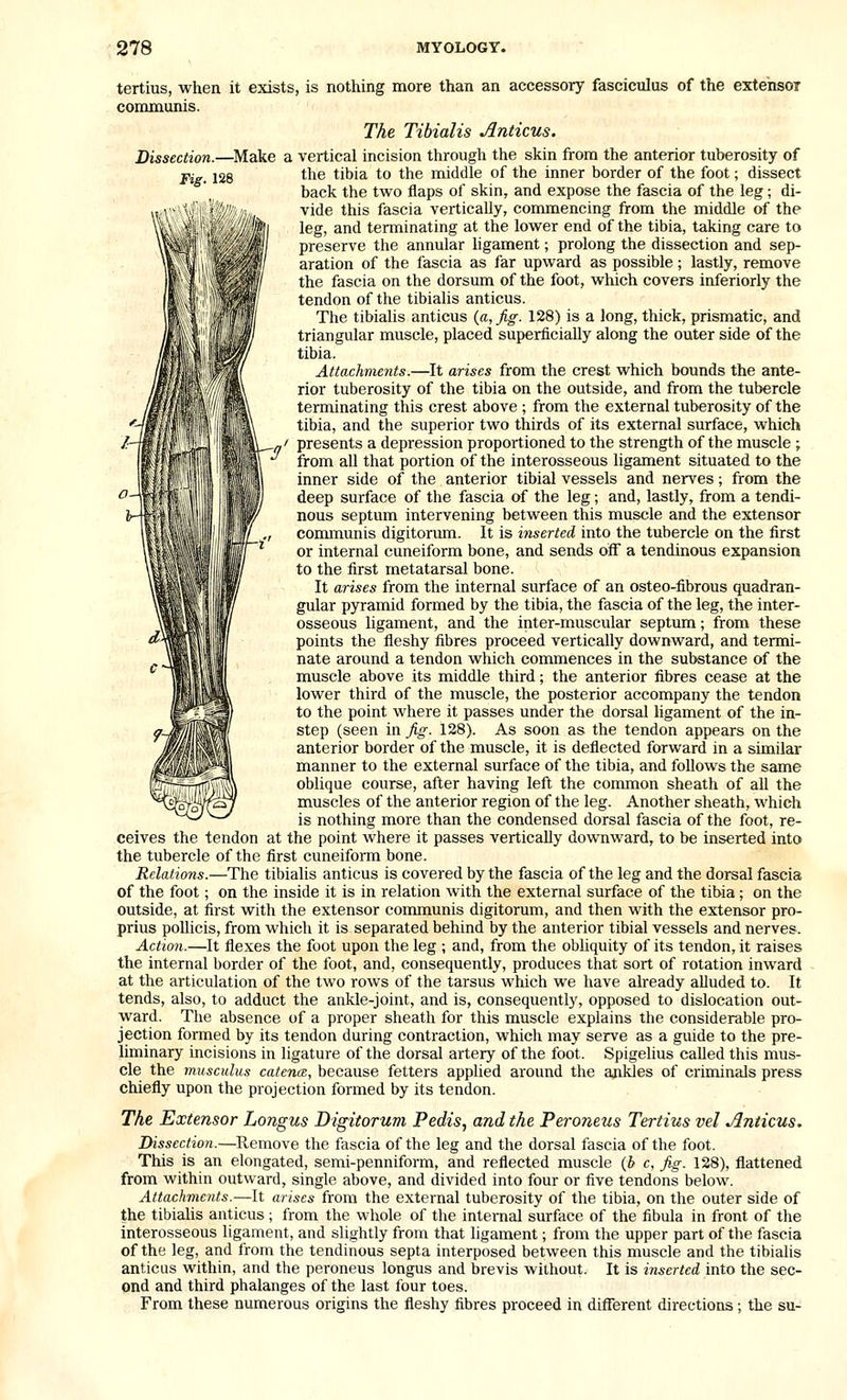 tertius, when it exists, is nothing more than an accessory fasciculus of the extensor communis. The Tibialis Anticus. Dissection.—Make a vertical incision through the skin from the anterior tuberosity of Fig. 128 the tibia to the middle of the inner border of the foot; dissect back the two flaps of skin, and expose the fascia of the leg; di- vide this fascia vertically, commencing from the middle of the leg, and terminating at the lower end of the tibia, taking care to preserve the annular ligament; prolong the dissection and sep- aration of the fascia as far upward as possible ; lastly, remove the fascia on the dorsum of the foot, which covers inferiorly the tendon of the tibiahs anticus. The tibialis anticus {a, fig. 128) is a long, thick, prismatic, and triangular muscle, placed superficially along the outer side of the tibia. Attachments.—It arises from the crest which bounds the ante- rior tuberosity of the tibia on the outside, and from the tubercle terminating this crest above ; from the external tuberosity of the tibia, and the superior two thirds of its external surface, which presents a depression proportioned to the strength of the muscle ; from all that portion of the interosseous ligament situated to the inner side of the anterior tibial vessels and nerves; from the deep surface of the fascia of the leg; and, lastly, from a tendi- nous septum intervening between this muscle and the extensor communis digitorum. It is inserted into the tubercle on the first or internal cuneiform bone, and sends off a tendinous expansion to the first metatarsal bone. It arises from the internal surface of an osteo-fibrous quadran- gular pyramid formed by the tibia, the fascia of the leg, the inter- osseous ligament, and the inter-muscular septum; from these points the fleshy fibres proceed vertically downward, and termi- nate around a tendon which commences in the substance of the muscle above its middle third; the anterior fibres cease at the lower third of the muscle, the posterior accompany the tendon to the point where it passes under the dorsal ligament of the in- step (seen in fig. 128). As soon as the tendon appears on the anterior border of the muscle, it is deflected forward in a similar manner to the external surface of the tibia, and follows the same oblique course, after having left the common sheath of all the muscles of the anterior region of the leg. Another sheath, which is nothing more than the condensed dorsal fascia of the foot, re- ceives the tendon at the point where it passes vertically downward, to be inserted into the tubercle of the first cuneiform bone. Relations.—The tibialis anticus is covered by the fascia of the leg and the dorsal fascia of the foot; on the inside it is in relation with the external surface of the tibia ; on the outside, at first with the extensor communis digitorum, and then with the extensor pro- prius pollicis, from which it is separated behind by the anterior tibial vessels and nerves. Action.—It flexes the foot upon the leg ; and, from the obliquity of its tendon, it raises the internal border of the foot, and, consequently, produces that sort of rotation inward at the articulation of the two rows of the tarsus which we have already alluded to. It tends, also, to adduct the ankle-joint, and is, consequently, opposed to dislocation out- ward. The absence of a proper sheath for this muscle explains the considerable pro- jection formed by its tendon during contraction, which may serve as a guide to the pre- liminary incisions in ligature of the dorsal artery of the foot. Spigelius called this mus- cle the musculus catence, because fetters applied around the ajikles of criminals press chiefly upon the projection formed by its tendon. The Extensor Longus Digitorum Pedis, and the Pero7ieus Tertius vel Anticus. Dissection.—Remove the fascia of the leg and the dorsal fascia of the foot. This is an elongated, semi-penniform, and reflected muscle (b c, Jig. 128), flattened from within outward, single above, and divided into four or five tendons below. Attachments.—It arises from the external tuberosity of the tibia, on the outer side of the tibialis anticus ; from the whole of the internal surface of the fibula in front of the interosseous ligament, and slightly from that ligament; from the upper part of the fascia of the leg, and from the tendinous septa interposed between this muscle and the tibialis anticus within, and the peroneus longus and brevis without. It is inserted into the sec- ond and third phalanges of the last four toes. From these numerous origins the fleshy fibres proceed in different directions; the su-