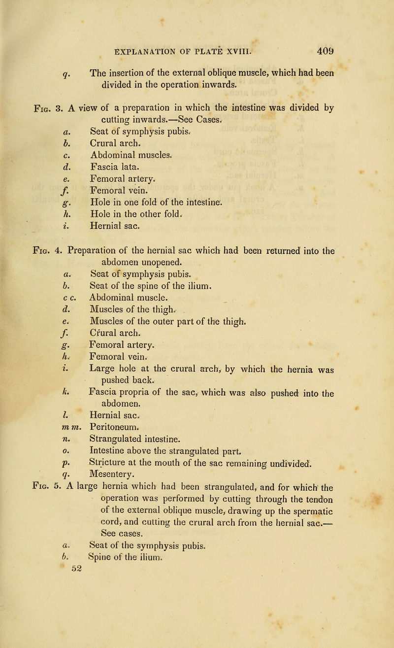The insertion of the external oblique muscle, which had been divided in the operation inwards. Fig. 3. A view of a preparation in which the intestine was divided by cutting inwards.—See Cases. a. Seat of symphysis pubis. b. Crural arch. c. Abdominal muscles. d. Fascia lata. e. Femoral artery. /• Femoral vein. S- Hole in one fold of the intestine. h. Hole in the other fold. i. Hernial sac. Fig. 4. Preparation of the hernial sac which had been returned into the abdomen unopened. a. Seat of symphysis pubis. 6. Seat of the spine of the ilium. c c. Abdominal muscle. d. Muscles of the thigh. . e. Muscles of the outer part of the thigh. /. Crural arch. g. Femoral artery. h. Femoral vein. i. Large hole at the crural arch, by which the hernia was pushed back. k. Fascia propria of the sac, which was also pushed into the abdomen. /. Hernial sac. m m. Peritoneum. n. Strangulated intestine. o. Intestine above the strangulated part. p. Stricture at the mouth of the sac remaining undivided. q. Mesentery. Fig. 5. A large hernia which had been strangulated, and for which the operation was performed by cutting through the tendon of the external oblique muscle, drawing up the spermatic cord, and cutting the crural arch from the hernial sac- See cases. a. Seat of the symphysis pubis. 6. Spine of the ilium. 52