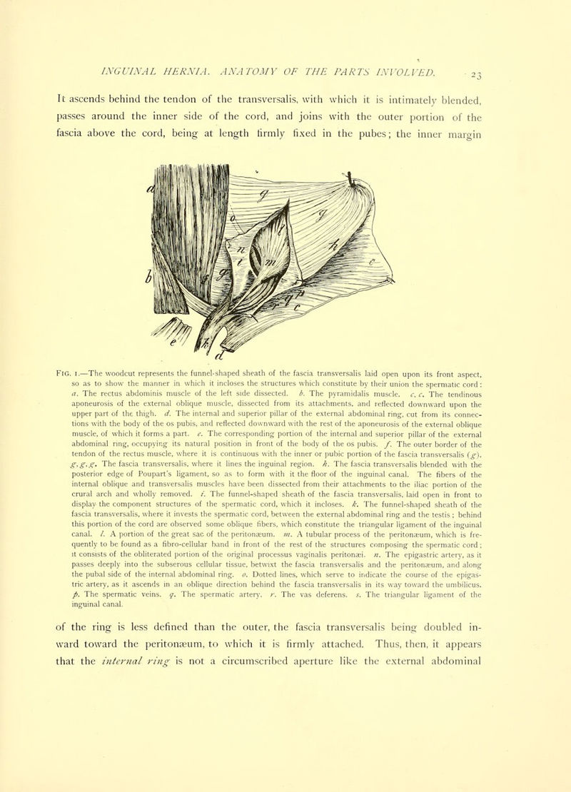 It ascends behind the tendon of the transversalis, with which it is intimately blended, passes around the inner side of the cord, and joins with the outer portion of the fascia above the cord, being at length tirmly fixed in the pubes; the inner margin Fig. I.—The woodcut represents the funnel-shaped sheath of the fascia transversalis laid open upon its front aspect, so as to show the manner in which it incloses the structures which constitute by their union the spermatic cord : a. The rectus abdominis muscle of the left side dissected. b. The pyramidalis muscle, c, c. The tendinous aponeurosis of the external oblique muscle, dissected from its attachments, and reflected downward upon the upper part of the thigh, d. The internal and superior pillar of the external abdominal ring, cut from its connec- tions with the body of the os pubis, and reflected downward with the rest of the aponeurosis of the external oblique muscle, of which it forms a part. e. The corresponding portion of the internal and superior pillar of the external abdominal ring, occupying its natural position in front of the body of the os pubis, f. The outer border of the tendon of the rectus muscle, where it is continuous with the inner or pubic portion of the fascia transversalis {g). g,g,g. The fascia transversalis, where it lines the inguinal region, h. The fascia transversalis blended with the posterior edge of Poupart's ligament, so as to form with it the floor of the inguinal canal. The fibers of the internal oblique and transversalis muscles have been dissected from their attachments to the iliac portion of the crural arch and wholly removed, z. The funnel-shaped sheath of the fascia transversalis, laid open in front to display the component structures of the spermatic cord, which it incloses, k. The funnel-shaped sheath of the fascia transversalis, where it invests the spermatic cord, between the external abdominal ring and the testis ; behind this portion of the cord are observed some oblique fibers, which constitute the triangular ligament of the inguinal canal. /. A portion of the great sac of the peritonaeum, m. A tubular process of the peritoneum, which is fre- quently to be found as a fibro-cellular band in front of the rest of the structures composing the spermatic cord; U consists of the obliterated portion of the original processus vaginalis peritonei. «. The epigastric artery, as it passes deeply into the subserous cellular tissue, betwixt the fascia transversalis and the peritonseum, and along the pubal side of the internal abdominal ring. 0. Dotted lines, which serve to indicate the course of the epigas- tric artery, as it ascends in an oblique direction behind the fascia transversalis in its way toward the umbilicus. p. The spermatic veins, g. The spermatic artery, r. The vas deferens, s. The triangular ligament of the inguinal canal. of the ring is less defined than the outer, the fascia transversalis being doubled in- ward toward the peritonfeum, to which it is firmly attached. Thus, then, it appears that the internal ring is not a circumscribed aperture like the external abdominal