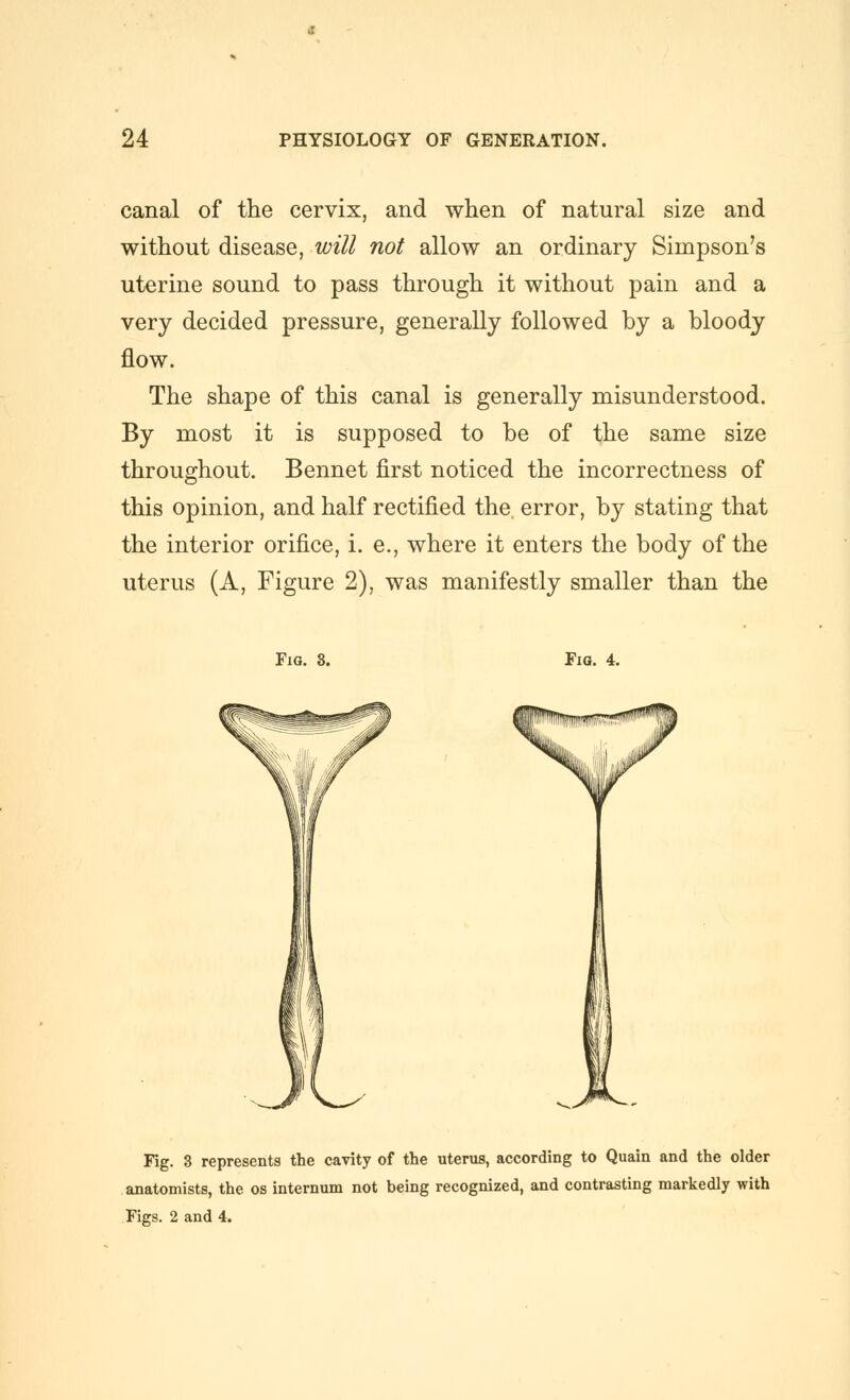 canal of the cervix, and when of natural size and without disease, will not allow an ordinary Simpson's uterine sound to pass through it without pain and a very decided pressure, generally followed by a bloody flow. The shape of this canal is generally misunderstood. By most it is supposed to be of the same size throughout. Bennet first noticed the incorrectness of this opinion, and half rectified the, error, by stating that the interior orifice, i. e., where it enters the body of the uterus (A, Figure 2), was manifestly smaller than the Fig. 8. Fig. 4. Fig. 3 represents the cavity of the uterus, according to Quain and the older anatomists, the os internum not being recognized, and contrasting markedly with Figs. 2 and 4.