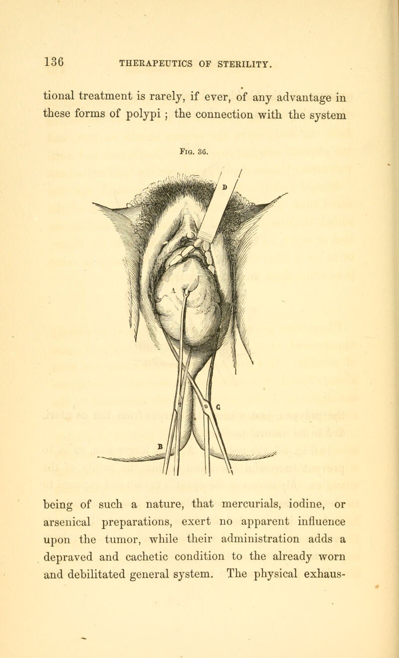 tional treatment is rarely, if ever, of any advantage in these forms of polypi ; the connection with the system Fig. 3G. ,„ ,'W^,< / / being of such a nature, that mercurials, iodine, or arsenical preparations, exert no apparent influence upon the tumor, while their administration adds a depraved and cachetic condition to the already worn and debilitated general system. The physical exhaus-