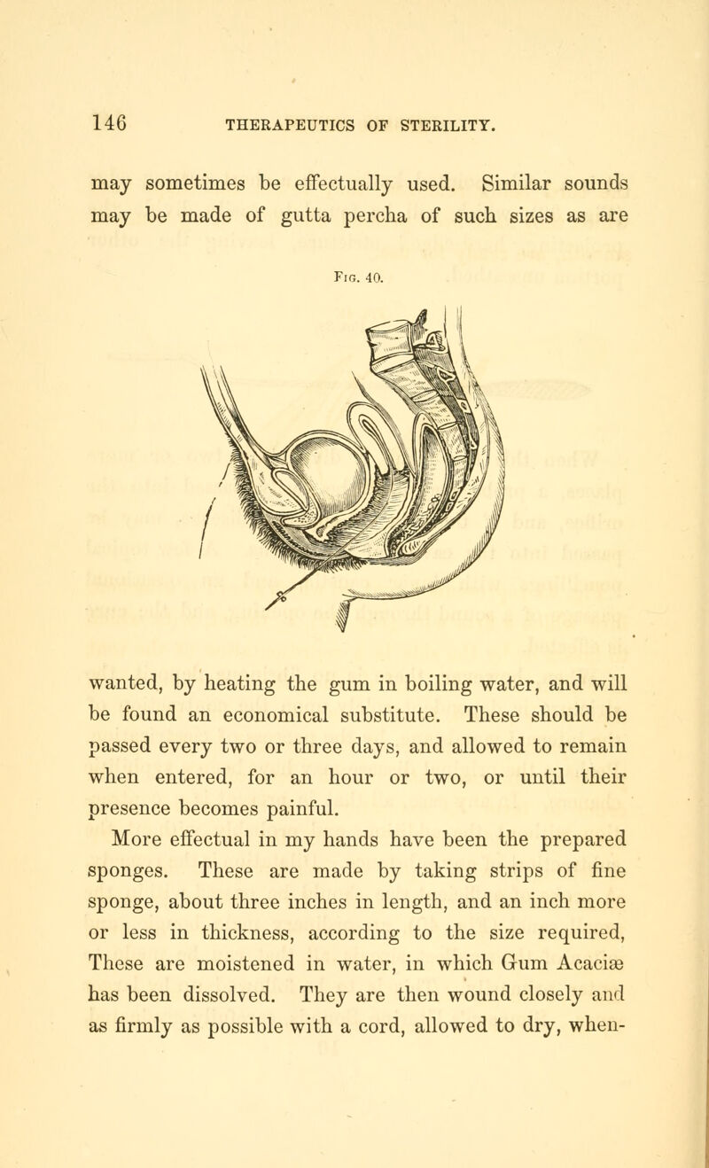 may sometimes be effectually used. Similar sounds may be made of gutta percha of such sizes as are Fig. 40. wanted, by heating the gum in boiling water, and will be found an economical substitute. These should be passed every two or three days, and allowed to remain when entered, for an hour or two, or until their presence becomes painful. More effectual in my hands have been the prepared sponges. These are made by taking strips of fine sponge, about three inches in length, and an inch more or less in thickness, according to the size required, These are moistened in water, in which Gum Acacice has been dissolved. They are then wound closely and as firmly as possible with a cord, allowed to dry, when-