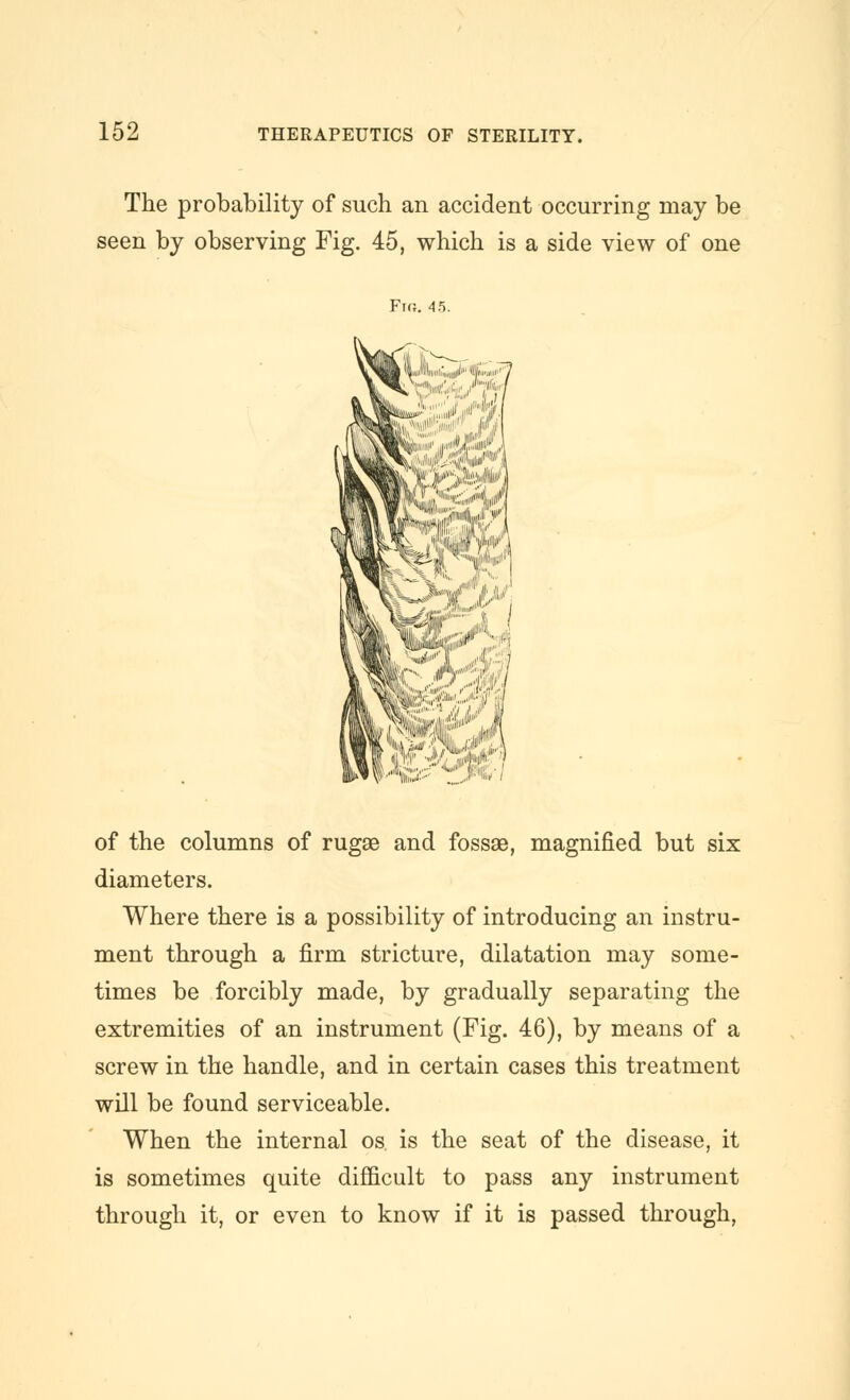 The probability of such an accident occurring may be seen by observing Fig. 45, which is a side view of one Ftg. 4.5. «i™iHiii;,,iiiiil*'</i'™«i''''/ A n't'' W^^ -'A i -.„ /ii,.«»**'iL('/ ,-'^J ...MJ i„„.,,..- <.*»' fc |iii'. 111, t i'M: of the columns of rugae and fossae, magnified but six diameters. Where there is a possibility of introducing an instru- ment through a firm stricture, dilatation may some- times be forcibly made, by gradually separating the extremities of an instrument (Fig. 46), by means of a screw in the handle, and in certain cases this treatment will be found serviceable. When the internal os is the seat of the disease, it is sometimes quite difficult to pass any instrument through it, or even to know if it is passed through,