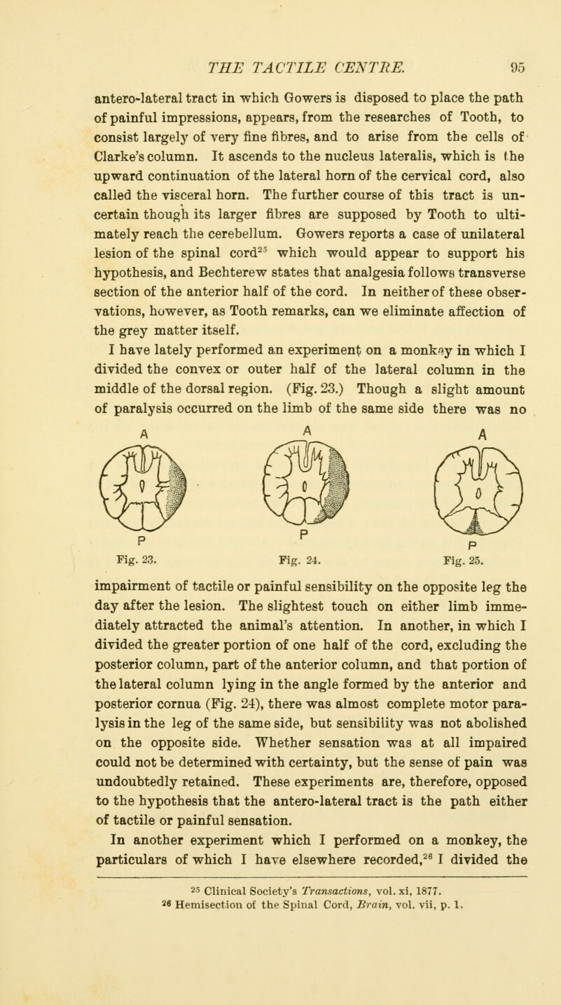 anterolateral tract in which Gowers is disposed to place the path of painful impressions, appears, from the researches of Tooth, to consist largely of very fine fibres, and to arise from the cells of Clarke's column. It ascends to the nucleus lateralis, which is (he upward continuation of the lateral horn of the cerrical cord, also called the visceral horn. The further course of this tract is un- certain though its larger fibres are supposed by Tooth to ulti- mately reach the cerebellum. Gowers reports a case of unilateral lesion of the spinal cord^^ which would appear to support his hypothesis, and Bechterew states that analgesia follows transverse section of the anterior half of the cord. In neither of these obser- vations, however, as Tooth remarks, can we eliminate affection of the grey matter itself. I have lately performed an experiment on a monk^iy in which I divided the convex or outer half of the lateral column in the middle of the dorsal region. (Fig. 23.) Though a slight amount of paralysis occurred on the limb of the same side there was no A A A impairment of tactile or painful sensibility on the opposite leg the day after the lesion. The slightest touch on either limb imme- diately attracted the animal's attention. In another, in which I divided the greater portion of one half of the cord, excluding the posterior column, part of the anterior column, and that portion of the lateral column lying in the angle formed by the anterior and posterior cornua (Fig. 24), there was almost complete motor para- lysis in the leg of the same side, but sensibility was not abolished on the opposite side. Whether sensation was at all impaired could not be determined with certainty, but the sense of pain was undoubtedly retained. These experiments are, therefore, opposed to the hypothesis that the antero-lateral tract is the path either of tactile or painful sensation. In another experiment which I performed on a monkey, the particulars of which I have elsewhere recorded,^^ I divided the 23 Clinical Society's Transactions, vol.xi, 1877. 26 Hemisection of the Spinal Cord, Brain, vol. vii, p. 1.