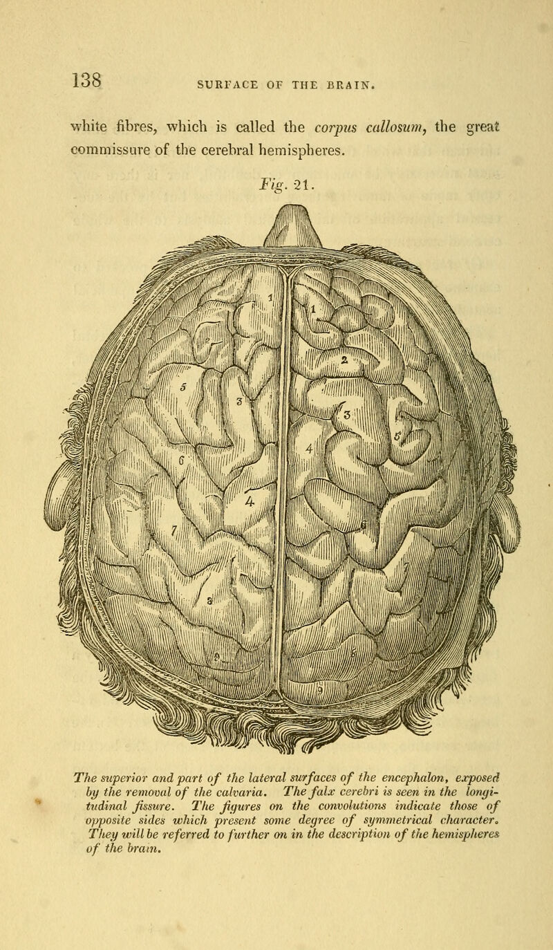 SURFACE OF THE BRAIN. white fibres, which is called the corpus callosum, the great commissure of the cerebral hemispheres. Fig. 21. The superior and part of the lateral surfaces of the encephalon, exposed by the removal of the calvaria. The falx cerebri is seen in the longi- tudinal fissure. The figures on the convolutions indicate tlwse of opposite sides which present some degree of symmetrical character. They will be referred to further on in the description of the hemispheres of the brain.