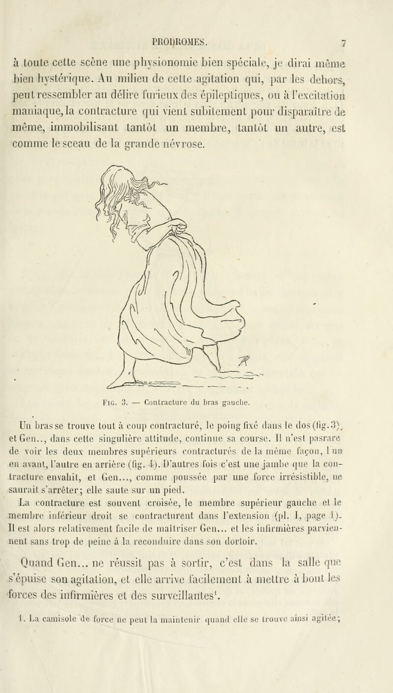 à toute cette scène une physionomie bien spéciale, je dirai même bien hystérique. Au miheu de cette agitation qui, par les dehors, peut ressembler au délire furieux des épileptiques, ou à l'excilation maniaque, la contracture qui vient subitement pour disparaître de même, immobilisant tantôt un membre, tantôt un autre, est comme le sceau de la grande névrose. FiG. Contracture du bras erauclie. Un brasse trouve tout à coup contracture, le poing fixé dans le ilos(fig.3), etGon.., dans cette singulière attitude, continue sa course. Il n'est pasrare de voiries deux membres supérieurs contractures de la même façon, lui) en avant, l'autre en arrière (fig. 4). D'autres fois c'est une jambe que la con- tracture envahit, et Gen..., comme poussée par une force irrésistible, ne saurait s'arrêter; elle saute sur un pied. La contracture est souvent croisée, le membre supérieur gauche et le membre inférieur droit se contracturent dans l'extension (pi. I, page 1). Il est alors relativement facile de maîtriser Gen... et les infirmières parvien- nent sans trop de peine à la reconduire dans son dortoir. Quand Gen... ne réussit pas à sortir, c'est dans la salle que s'épuise son agitation, et elle arrive facilement à mettre à bout les foi^ces des infirmières et des surveillantes*. 1. La camisole de force ne peut la maintenir quand elle se trouve ainsi agitée;