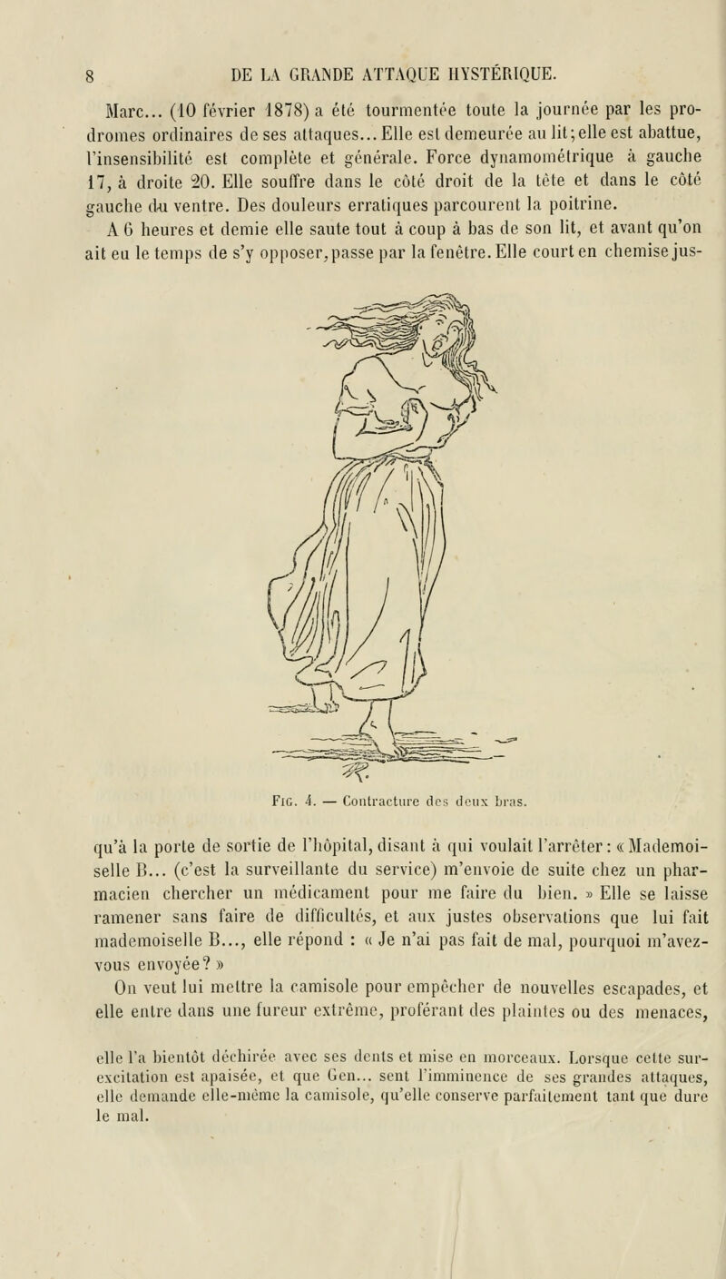 Marc... (10 février 1878) a été tourmentée toute la journée par les pro- dromes ordinaires de ses attaques... Elle est demeurée au lit;elle est abattue, rinsensibilité est complète et générale. Force dynamométrique à gauche 17, à droite 20. Elle soufTre dans le côté droit de la tète et dans le côté gauche d-u ventre. Des douleurs erratiques parcourent la poitrine. A 6 heures et demie elle saute tout à coup à bas de son lit, et avant qu'on ait eu le temps de s'y opposer, passe par la fenêtre. Elle court en chemise jus- Fic. i. — Contracture des deux bras. qu'à la porte de sortie de l'hôpital, disant à qui voulait l'arrêter : « Mademoi- selle B... (c'est la surveillante du service) m'envoie de suite chez un phar- macien chercher un médicament pour me faire du bien. » Elle se laisse ramener sans faire de difficultés, et aux justes observations que lui fait mademoiselle B..., elle répond : « Je n'ai pas fait de mal, pourquoi m'avez- vous envoyée? » On veut lui mettre la camisole pour empêcher de nouvelles escapades, et elle entre dans une fureur extrême, proférant des plaintes ou des menaces, elle l'a bientôt déchirée avec ses dents et mise en morceaux. Lorsque celte sur- excitation est apaisée, et que Gen... sent riniminoace de ses grandes attaques, elle demande elle-même la camisole, qu'elle conserve parfaitement tant que dure le mal.