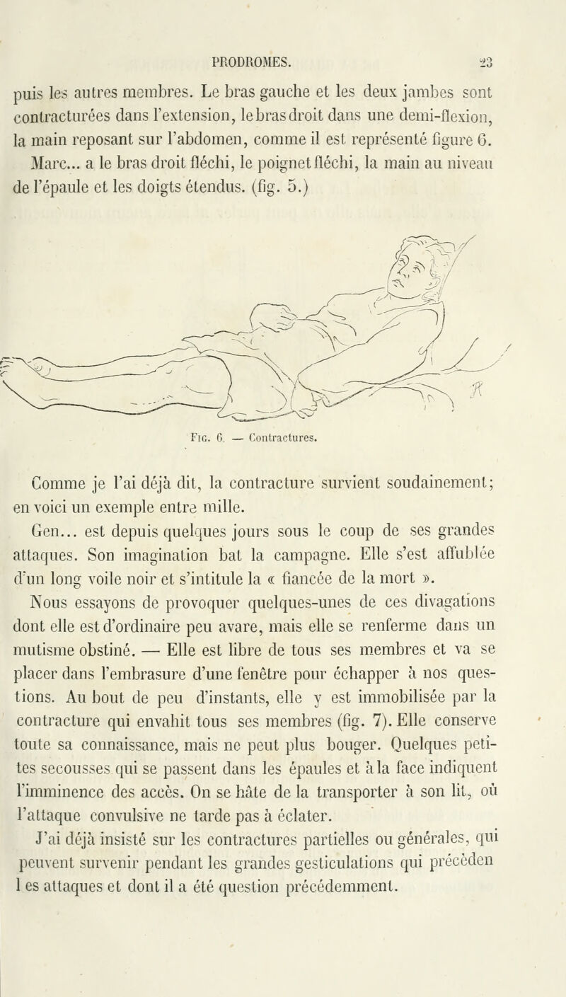 puis les autres membres. Le bras gauche et les deux jambes sont conlracturées dans l'extension, le bras droit dans une demi-flexion, la main reposant sur l'abdomen, comme il est représenté figure 6. Marc... a le bras droit fléchi, le poignet fléchi, la main au niveau de l'épaule et les doigts étendus, (fig. 5.) FiG. 6. — Contractures. Comme je l'ai déjà dit, la contracture survient soudainement; en voici un exemple entre mille. Gen... est depuis quelques jours sous le coup de ses grandes attaques. Son imagination bat la campagne. Elle s'est affublée d'un long voile noir et s'intitule la « fiancée de la mort ». Nous essayons de provoquer quelques-unes de ces divagations dont elle est d'ordinaire peu avare, mais elle se renferme dans un mutisme obstiné. — Elle est libre de tous ses m.embres et va se placer dans l'embrasure d'une fenêtre pour échapper à nos ques- tions. Au bout de peu d'instants, elle y est immobilisée par la contracture qui envahit tous ses membres (fig. 7). Elle conserve toute sa connaissance, mais ne peut plus bouger. Quelques peti- tes secousses qui se passent dans les épaules et à la face indiquent l'imminence des accès. On se hâte de la transporter à son lit, où l'attaque convulsive ne tarde pas à éclater. J'ai déjà insisté sur les contractures partielles ou générales, qui peuvent survenir pendant les grandes gesticulations qui précèden 1 es attaques et dont il a été question précédemment.