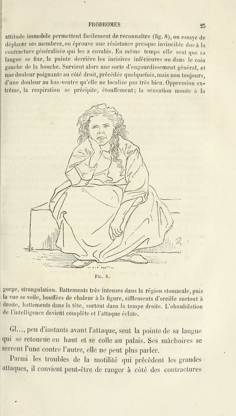 attitude immobile permettent facilement de reconnaître (fig. 8), on essaye de déplacer ses membres, on éprouve une résistance presque invincible due à la contracture généralisée qui les a envahis. En même temps elle sent que sa langue se fixe, la pointe derrière les incisives inférieures ou dans le coin gauche de la bouche. Survient alors une sorte d'engourdissement général, et une douleur poignante au côté droit, précédée quelquefois, mais non toujours, d'une douleur au bas-ventre qu'elle ne localise pas très bien. Oppression ex- trême, la respiration se précipite, étouffement; la sensation monte à la gorge, strangulation. Battements très intenses dans la région stomacale, puis la vue se voile, bouffées de chaleur à îa figure, sifflements d'oreille surtout à droite, battements dans la tête, surtout dans la tempe droite. L'obnubilation de l'intelligence devient complète et l'attaque éclate. Gl..., peu d'instants avant l'attaque, sent la pointe de sa langue qui se retourne en haut et se colle au palais. Ses mâchoires se serrent l'une contre l'autre, elle ne peut plus parler. Parmi les troubles de la motilité qui précèdent les grandes attaques, il convient peut-être de ranger à côté des contractures