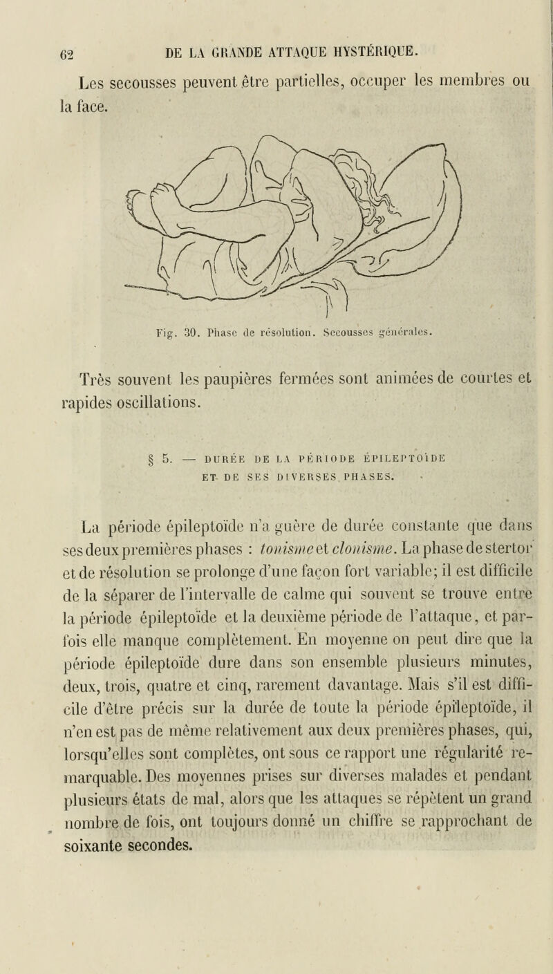 Les secousses peuvent .être partielles, occuper les membres ou la face. Fig. 30. Phase île résolution. Secousses générales. Très souvent les paupières fermées sont animées de courtes et rapides oscillations. §5. — DURÉE DE LA PÉRIODE ÉPILEPTOlDE ET DE SES DIVERSES PHASES. La période épileptoïde n a guère de durée constante que dans ses deux premières phases : tonisme et donisme. La phase de stertor et de résolution se prolonge d'une façon fort variable; il est difficile de la séparer de l'intervalle de calme qui souvent se trouve entre la période épileptoïde et la deuxième période de l'attaque, et par- fois elle manque complètement. En moyenne on peut dire que la période épileptoïde dure dans son ensemble plusieurs minutes, deux, trois, quatre et cinq, rarement davantage. Mais s'il est diffi- cile d'être précis sur la durée de toute la période épileptoïde, il n'en est pas de même relativement aux deux premières phases, qui, lorsqu'elles sont complètes, ont sous ce rapport une régularité re- marquable. Des moyennes prises sur diverses malades et pendant plusieurs états de mal, alors que les attaques se répètent un grand nombre de fois, ont toujours donné un chiffre se rapprochant de soixante secondes.