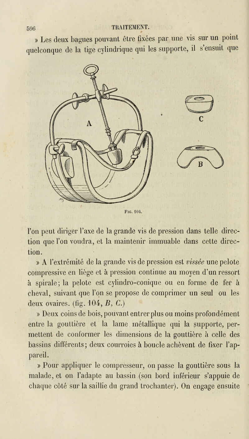 » Les deux bagues pouvant être fixées par une vis sur un point quelconque de la tige cylindrique qui les supporte, il s'ensuit que FiG. 104. Ton peut diriger l'axe de la grande vis de pression dans telle direc- tion que l'on voudra, et la maintenir immuable dans cette direc- tion. y> A l'extrémité de la grande vis de pression est vissée une pelote compressive en liège et à pression continue au moyen d'un ressort à spirale; la pelote est cylindro-conique ou en forme de fer à cheval, suivant que l'on se propose de comprimer un seul ou les deux ovaires, (fig. 404, ^, C.) )) Deux coins de bois, pouvant entrer plus ou moins profondément entre la gouttière et la lame métallique qui la supporte, per- mettent de conformer les dimensions de la gouttière à celle des bassins différents ; deux courroies à boucle achèvent de fixer l'ap- pareil. D Pour appliquer le compresseur, on passe la gouttière sous la malade, et on l'adapte au bassin (son bord inférieur s'appuie de chaque côté sur la saillie du grand trochanter). On engage ensuite