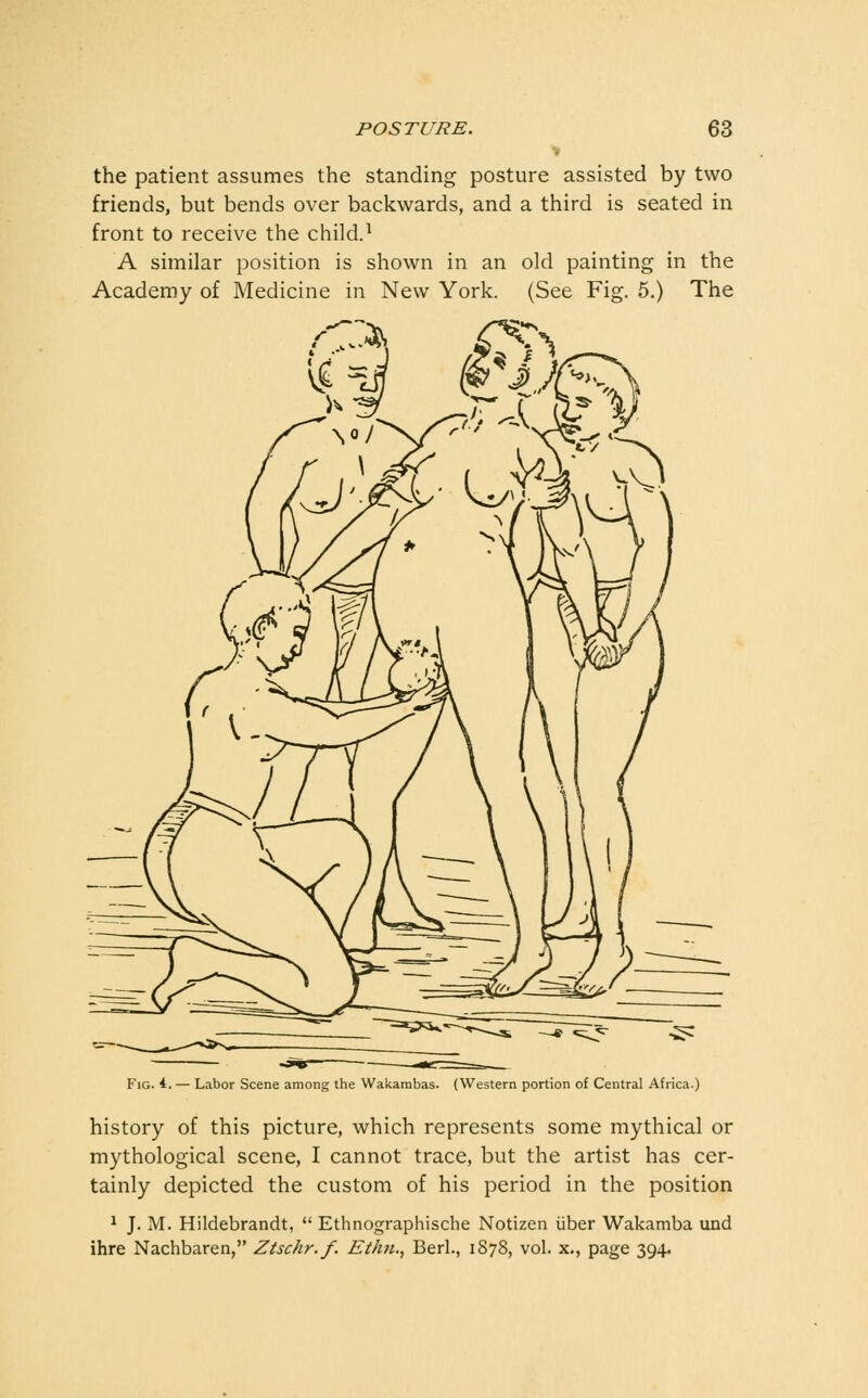 the patient assumes the standing posture assisted by two friends, but bends over backwards, and a third is seated in front to receive the child.^ A similar position is shown in an old painting in the Academy of Medicine in New York. (See Fig. 5.) The Fig. 1. — Labor Scene among the Wakarabas. (Western portion of Central Africa.) history of this picture, which represents some mythical or mythological scene, I cannot trace, but the artist has cer- tainly depicted the custom of his period in the position ^ J. M. Hildebrandt,  Ethnographische Notizen iiber Wakamba und ihre Nachbaren, Ztschr.f. Ethn.^ Berl., 1878, vol. x,, page 394.