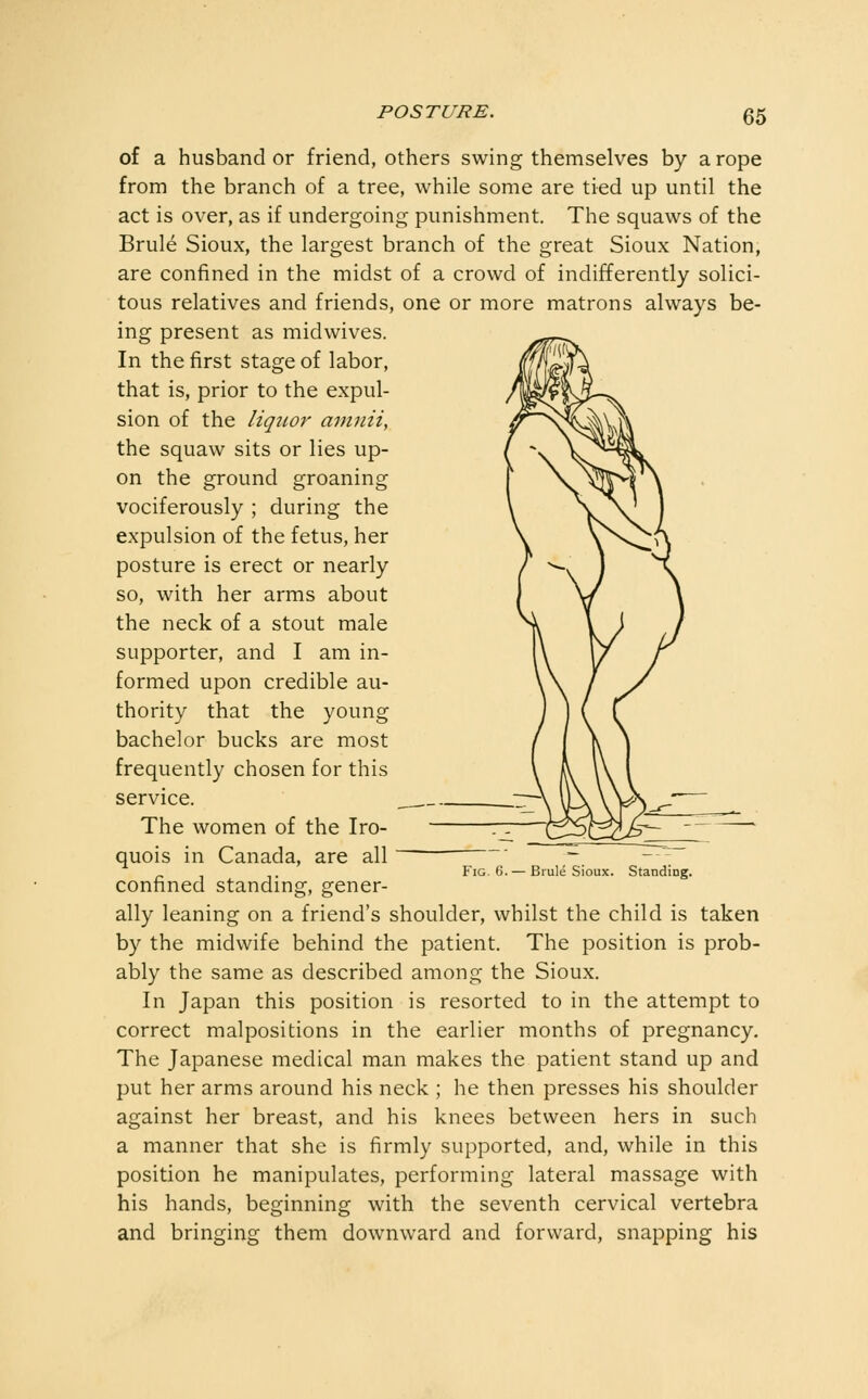 of a husband or friend, others swing themselves by a rope from the branch of a tree, while some are tied up until the act is over, as if undergoing punishment. The squaws of the Brule Sioux, the largest branch of the great Sioux Nation, are confined in the midst of a crowd of indifferently solici- tous relatives and friends, one or more matrons always be- ing present as midwives. In the first stage of labor, that is, prior to the expul- sion of the liqjior amnii, the squaw sits or lies up- on the ground groaning vociferously ; during the expulsion of the fetus, her posture is erect or nearly so, with her arms about the neck of a stout male supporter, and I am in- formed upon credible au- thority that the young bachelor bucks are most frequently chosen for this service. The women of the Iro- quois in Canada, are all confined standing, gener- ally leaning on a friend's shoulder, whilst the child is taken by the midwife behind the patient. The position is prob- ably the same as described among the Sioux. In Japan this position is resorted to in the attempt to correct malpositions in the earlier months of pregnancy. The Japanese medical man makes the patient stand up and put her arms around his neck ; he then presses his shoulder against her breast, and his knees between hers in such a manner that she is firmly supported, and, while in this position he manipulates, performing lateral massage with his hands, beginning with the seventh cervical vertebra and bringing them downward and forward, snapping his Fig. 6. — Brule Sioux. Standing.