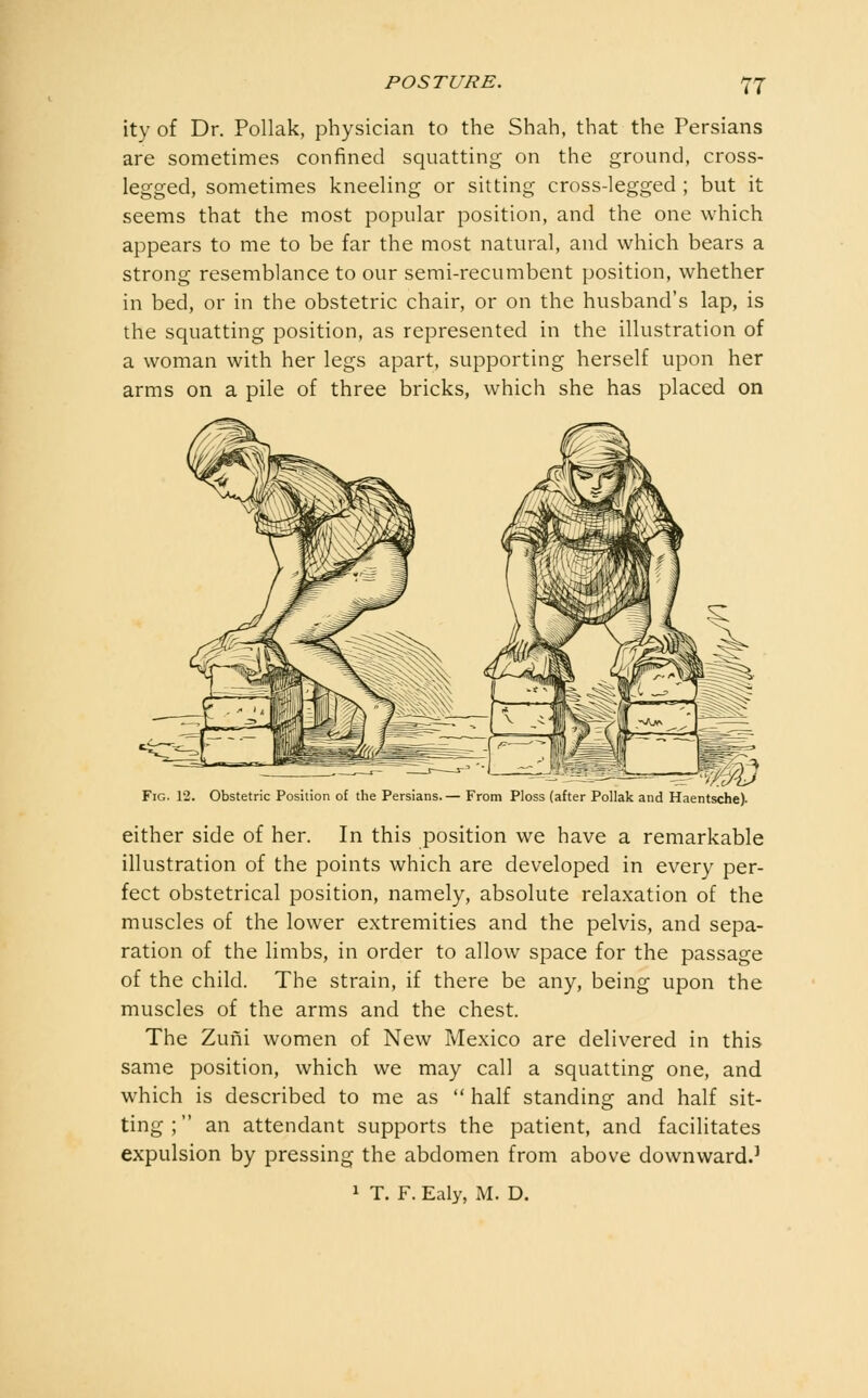 T7 ity of Dr. Pollak, physician to the Shah, that the Persians are sometimes confined squatting on the ground, cross- legged, sometimes kneeling or sitting cross-legged ; but it seems that the most popular position, and the one which appears to me to be far the most natural, and which bears a strong resemblance to our semi-recumbent position, whether in bed, or in the obstetric chair, or on the husband's lap, is the squatting position, as represented in the illustration of a woman with her legs apart, supporting herself upon her arms on a pile of three bricks, which she has placed on Fig. 12. Obstetric Position of the Persians.— From Ploss (after Pollak and Haentsche). either side of her. In this position we have a remarkable illustration of the points which are developed in every per- fect obstetrical position, namely, absolute relaxation of the muscles of the lower extremities and the pelvis, and sepa- ration of the limbs, in order to allow space for the passage of the child. The strain, if there be any, being upon the muscles of the arms and the chest. The Zuiii women of New Mexico are delivered in this same position, which we may call a squatting one, and which is described to me as  half standing and half sit- ting ; an attendant supports the patient, and facilitates expulsion by pressing the abdomen from above downward.' 1 T. F. Ealy, M. D.