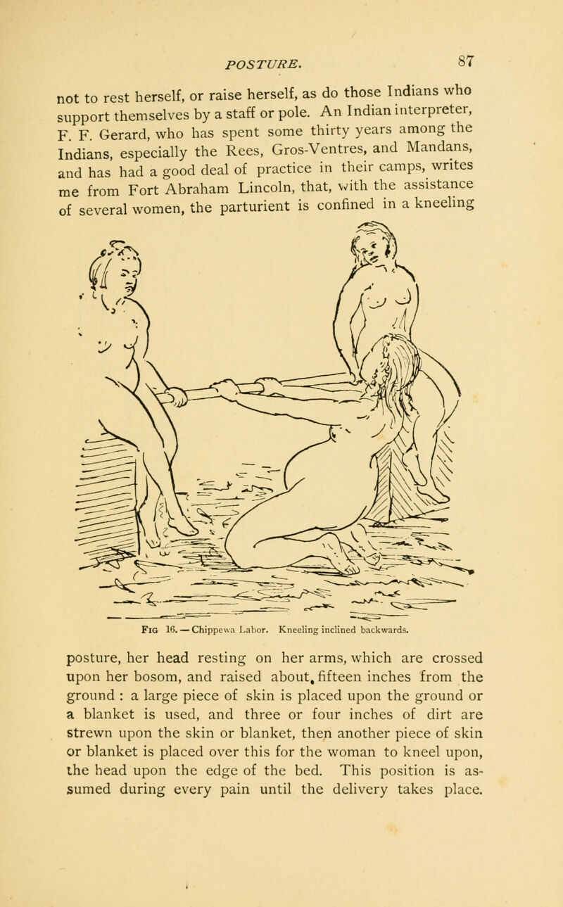 not to rest herself, or raise herself, as do those Indians who support themselves by a staff or pole. An Indian interpreter, F F. Gerard, who has spent some thirty years among the Indians, especially the Rees, Gros-Ventres, and Mandans, and has had a good deal of practice in their camps, writes me from Fort Abraham Lincoln, that, with the assistance of several women, the parturient is confined in a kneeling Fig 16. — Chippewa Labor. Kneeling inclined backwards. posture, her head resting on her arms, which are crossed upon her bosom, and raised about, fifteen inches from the ground : a large piece of skin is placed upon the ground or a blanket is used, and three or four inches of dirt are strewn upon the skin or blanket, then another piece of skin or blanket is placed over this for the woman to kneel upon, the head upon the edge of the bed. This position is as- sumed during every pain until the delivery takes place.