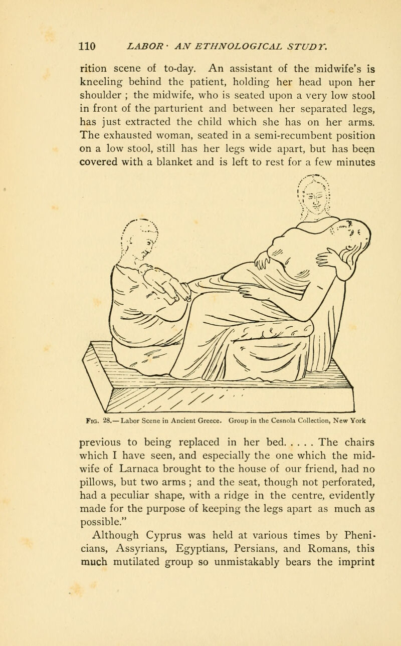 rition scene of to-day. An assistant of the midwife's is kneeling behind the patient, holding her head upon her shoulder ; the midwife, who is seated upon a very low stool in front of the parturient and between her separated legs, has just extracted the child which she has on her arms. The exhausted woman, seated in a semi-recumbent position on a low stool, still has her legs wide apart, but has been covered with a blanket and is left to rest for a few minutes Fig. 28.— Labor Scene in Ancient Greece. Group in the Cesnola Collection, New York previous to being replaced in her bed The chairs which I have seen, and especially the one which the mid- wife of Larnaca brought to the house of our friend, had no pillows, but two arms ; and the seat, though not perforated, had a peculiar shape, with a ridge in the centre, evidently made for the purpose of keeping the legs apart as much as possible. Although Cyprus was held at various times by Pheni- cians, Assyrians, Egyptians, Persians, and Romans, this much mutilated group so unmistakably bears the imprint