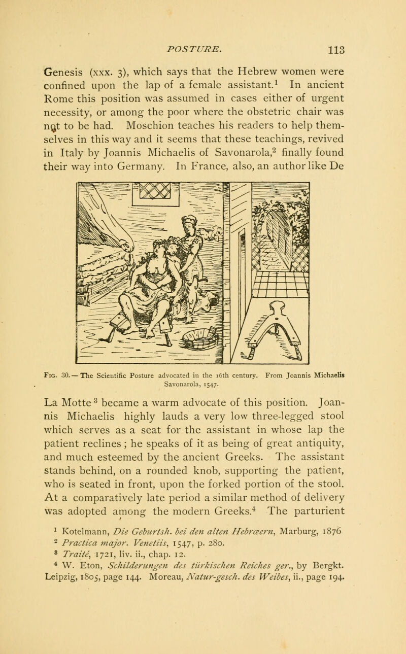 Genesis (xxx. 3), which says that the Hebrew women were confined upon the lap of a female assistant.^ In ancient Rome this position was assumed in cases either of urgent necessity, or among the poor where the obstetric chair was nQt to be had. Moschion teaches his readers to help them- selves in this way and it seems that these teachings, revived in Italy by Joannis Michaelis of Savonarola,^ finally found their way into Germany. In France, also, an author like De Fig. 30. — The Scientific Posture advocated in the i6th century. From Joannis Michaelis Savonarola, 1547. La Motte ^ became a warm advocate of this position. Joan- nis Michaelis highly lauds a very low three-legged stool which serves as a seat for the assistant in whose lap the patient reclines; he speaks of it as being of great antiquity, and much esteemed by the ancient Greeks. The assistant stands behind, on a rounded knob, supporting the patient, who is seated in front, upon the forked portion of the stool. At a comparatively late period a similar method of delivery was adopted among the modern Greeks.'^ The parturient ^ Kotelmann, Die Gehurtsh. bei den alien Hebrceern, Marburg, 1S76 ^ Practica 7najor. Venetiis, 1547, p. 280. 8 Traite, 1721, liv. ii., chap. 12. * W. Eton, Schilderiingcn dcs tiirkischen Retches ger., by Bergkt. Leipzig, 1S05, page 144. Moreau. A'atur-gesch. des Weibes, ii., page 194.