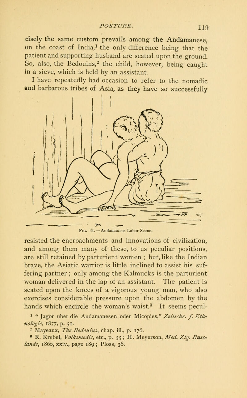 cisely the same custom prevails among the Andamanese, on the coast of India,^ the only difference being that the patient and supporting husband are seated upon the ground. So, also, the Bedouins,^ the child, however, being caught in a sieve, which is held by an assistant. I have repeatedly had occasion to lefer to the nomadic and barbarous tribes of Asia, as they have so successfully — ?>. ___ Fig. 34.— Andamanese Labor Scene. resisted the encroachments and innovations of civilization, and among them many of these, to us peculiar positions, are still retained by parturient women ; but, like the Indian brave, the Asiatic warrior is little inclined to assist his suf- fering partner ; only among the Kalmucks is the parturient woman delivered in the lap of an assistant. The patient is seated upon the knees of a vigorous young man, who also exercises considerable pressure upon the abdomen by the hands which encircle the woman's waist.^ It seems pecul- ^  Jagor uber die Andamanesen oder Micopies, Zeitschr. f, Eth- nologie, 1877, p. 51. ■-' Mayeaux, The Bedotims, chap, iii., p. 176. • R. Krebel, Volksmedic, etc., p. 55; H. Meyerson, Med. Ztg. Russ- lands^ i860, xxiv., page 189 ; Ploss, 36.