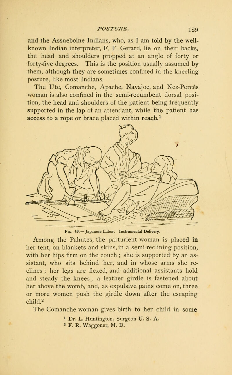 and the Assneboine Indians, who, as I am told by the well- known Indian interpreter, F. F. Gerard, lie on their backs, the head and shoulders propped at an angle of forty or forty-five degrees. This is the position usually assumed by them, although they are sometimes confined in the kneeling posture, like most Indians. The Ute, Comanche, Apache, Navajoe, and Nez-Perces woman is also confined in the semi-recumbent dorsal posi- tion, the head and shoulders of the patient being frequently supported in the lap of an attendant, while the patient has access to a rope or brace placed within reach. ^ Fig. 49. — Japanese Labor. Instrumental Delivery. Among the Pahutes, the parturient woman is placed in her tent, on blankets and skins, in a semi-reclining position, with her hips firm on the couch ; she is supported' by an as- sistant, who sits behind her, and in whose arms she re- clines ; her legs are flexed, and additional assistants hold and steady the knees ; a leather girdle is fastened about her above the womb, and, as expulsive pains come on, three or more women push the girdle down after the escaping child.2 The Comanche woman gives birth to her child in some ^ Dr. L. Huntington, Surgeon U. S. A. ^ F, R. Waggoner, M. D.