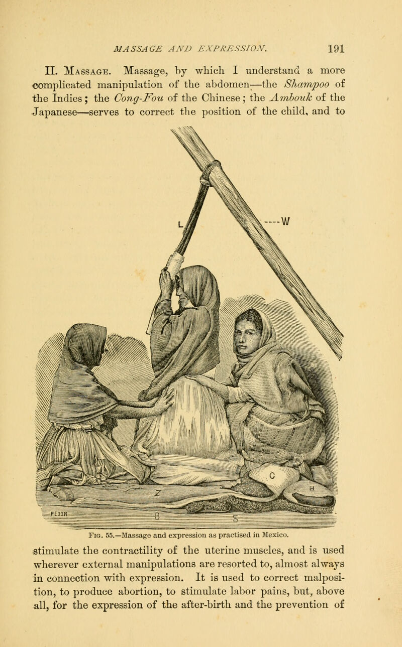 II. Massage. Massage, by which I understand a more complicated manipulation of the abdomen^—the Shampoo of the Indies; the Cong-Fou of the Chinese; the Ainhoxik of the Japanese—serves to correct \\\q position of the child, and to Fig. 55.—Massage and expression as practised in Mexico. stimulate the contractility of the uterine muscles, and is used wherever external manipulations are resorted to, almost always in connection with expression. It is used to correct malposi- tion, to produce abortion, to stimulate labor pains, but, above all, for the expression of the after-birth and the prevention of