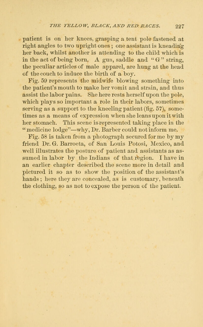 patient is on lier knees, grasping a tent pole fastened at right angles to two upright ones ; one assistant is kneading her back, whilst another is attending to the child which is in the act of being born. A gun, saddle and G string, the peculiar articles of male apparel, are hung at the head of the couch to induce the birth of a boy. Fig. 59 represents the midwife blowing something into the patient's mouth to njake her vomit and strain, and thus assist the labor pains. She here rests herself upon the pole, which plays so important a role in their labors, sometimes serving as a support to the kneeling patient (fig. 57), some- times as a means of expression when she leans upon it with her stomach. This scene is represented taking place in the medicine lodge—why, Dr. Barber could not inform me. Fig. 58 is taken from a photograph secured for me by my friend Dr. G. Barroeta, of San Louis Potosi, Mexico, and well illustrates the posture of patient and assistants as as- sumed in labor by the Indians of that region. I have in an earlier chapter described the scene more in detail and pictured it so as to show the position of the assistant's hands ; here they are concealed, as is customary, beneath the clothing, so as not to expose the person of the patient.