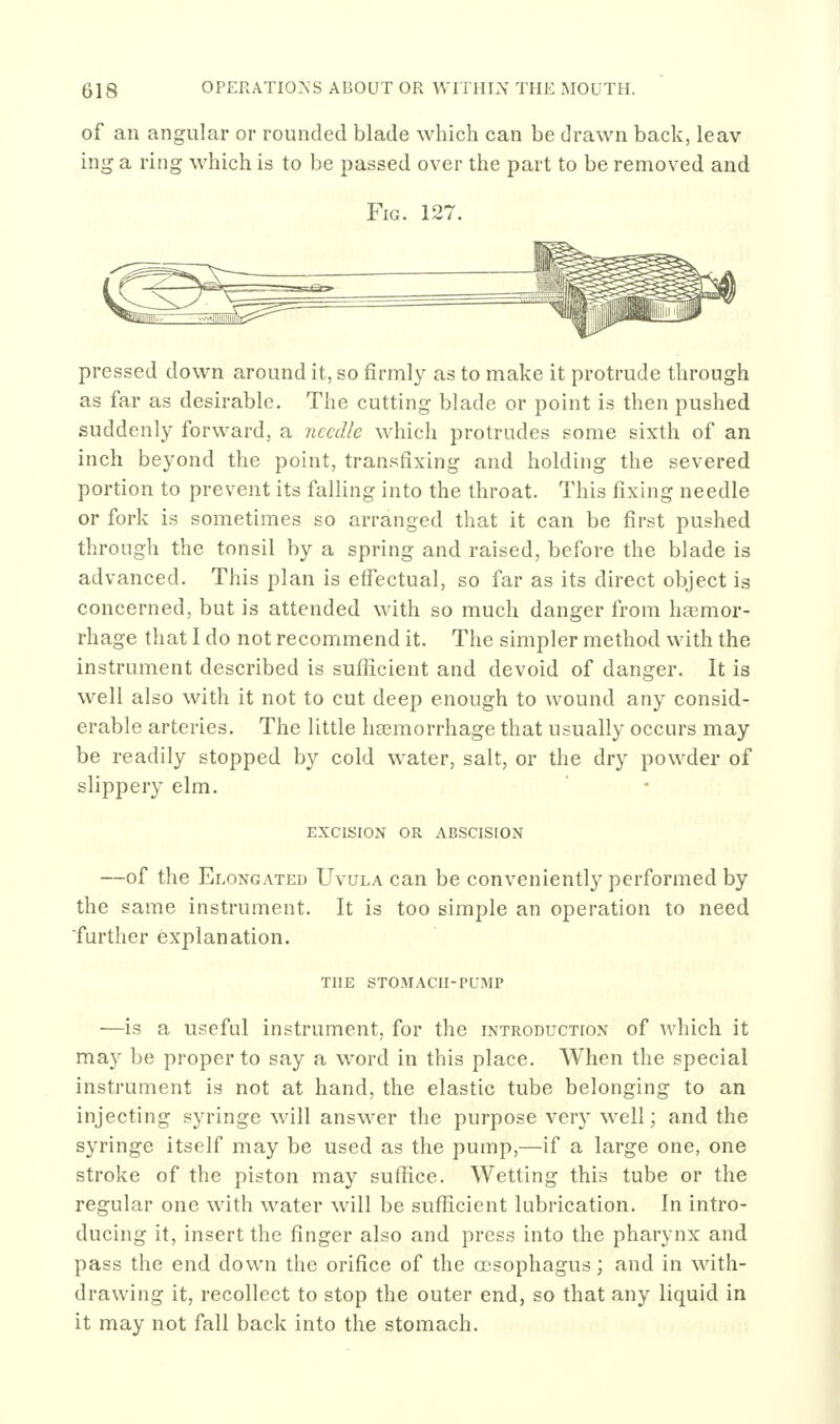 of an angular or rounded blade which can be drawn back, leav ing a ring which is to be passed over the part to be removed and Fig. 127. pressed down around it, so firmly as to make it protrude through as far as desirable. The cutting blade or point is then pushed suddenly forward, a needle which protrudes some sixth of an inch beyond the point, transfixing and holding the severed portion to prevent its falling into the throat. This fixing needle or fork is sometimes so arranged that it can be first pushed through the tonsil by a spring and raised, before the blade is advanced. This plan is effectual, so far as its direct object is concerned, but is attended with so much danger from ha3mor- rhage that I do not recommend it. The simpler method with the instrument described is suflicient and devoid of danger. It is well also with it not to cut deep enough to wound any consid- erable arteries. The little hasmorrhage that usually occurs may be readily stopped by cold water, salt, or the dry powder of slippery elm. EXCISION OR ABSCISION —of the Elongated Uvula can be conveniently performed by the same instrument. It is too simple an operation to need ■further explanation. THE STOMACH-PUMP —is a useful instrument, for the introduction of which it may be proper to say a word in this place. When the special instrument is not at hand, the elastic tube belonging to an injecting syringe will answer the purpose very well; and the syringe itself may be used as the pump,—if a large one, one stroke of the piston may suffice. Wetting this tube or the regular one with water will be sufficient lubrication. In intro- ducing it, insert the finger also and press into the pharynx and pass the end down the orifice of the cesophagus; and in with- drawing it, recofiect to stop the outer end, so that any liquid in it may not fall back into the stomach.
