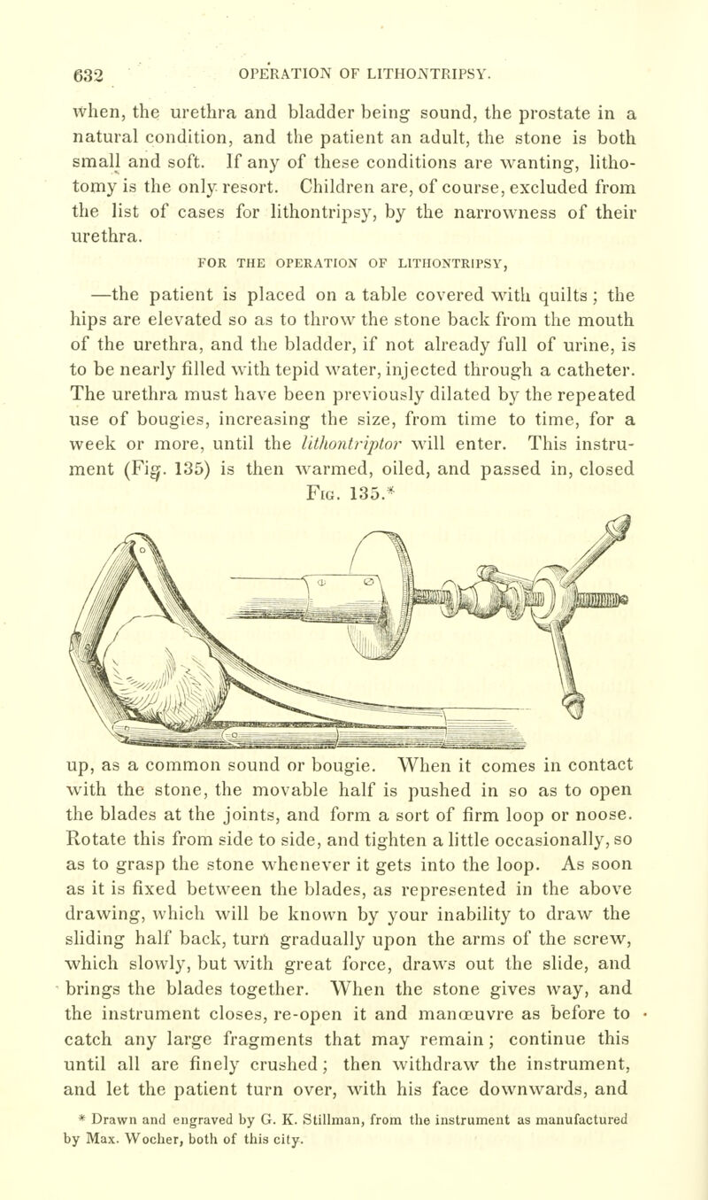 when, the urethra and bladder being sound, the prostate in a natural condition, and the patient an adult, the stone is both small and soft. If any of these conditions are wanting, litho- tomy is the only resort. Children are, of course, excluded from the list of cases for lithontripsy, by the narrowness of their urethra. FOR THE OPERATION OF LITHONTRIPSY, —the patient is placed on a table covered with quilts; the hips are elevated so as to throw the stone back from the mouth of the urethra, and the bladder, if not already full of urine, is to be nearly filled with tepid water, injected through a catheter. The urethra must have been previously dilated by the repeated use of bougies, increasing the size, from time to time, for a week or more, until the Uthontriptor will enter. This instru- ment (Fi^. 135) is then warmed, oiled, and passed in, closed Fig. 135.* up, as a common sound or bougie. When it comes in contact with the stone, the movable half is pushed in so as to open the blades at the joints, and form a sort of firm loop or noose. Rotate this from side to side, and tighten a little occasionally, so as to grasp the stone whenever it gets into the loop. As soon as it is fixed between the blades, as represented in the above drawing, which will be known by your inability to draw the sliding half back, turn gradually upon the arms of the screw, which slowly, but with great force, drawls out the slide, and brings the blades together. When the stone gives way, and the instrument closes, re-open it and manoeuvre as before to catch any large fragments that may remain; continue this until all are finely crushed; then withdraw the instrument, and let the patient turn over, with his face downwards, and * Drawn and engraved by G. K. Stillman, from tlie instrument as manufactured by Max. Wocher, both of this city.