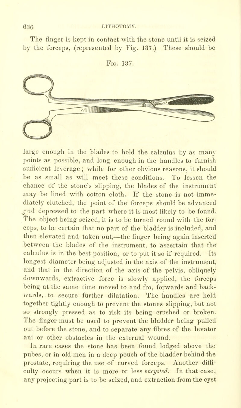The finger is kept in contact with the stone until it is seized by the forceps, (represented by Fig. 137.) These should be Fig. 137. large enough in the blades to hold the calculus by as many points as possible, and long enough in the handles to furnish sufficient leverage; while for other obvious reasons, it should be as small as will meet these conditions. To lessen the chance of the stone's slipping, the blades of the instrument may be lined with cotton cloth. If the stone is not imme- diately clutched, the point of the forceps should be advanced jnd depressed to the part where it is most likely to be found. The object being seized, it is to be turned round with the for- ceps, to be certain that no part of the bladder is included, and then elevated and taken out,—the finger being again inserted between the blades of the instrument, to ascertain that the calculus is in the best position, or to put it so if required. Its longest diameter being adjusted in the axis of the instrument, and that in the direction of the axis of the pelvis, obliquely downwards, extractive force is slowly applied, the forceps being at the same time moved to and fro, forwards and back- wards, to secure further dilatation. The handles are held together tightly enough to prevent the stones slipping, but not so strongly pressed as to risk its being crushed or broken. The finger must be used to prevent the bladder being pulled out before the stone, and to separate any fibres of the levator ani or other obstacles in the external wound. In rare cases the stone has been found lodged above the pubes, or in old men in a deep pouch of the bladder behind the prostate, requiring the use of curved forceps. Another diffi- culty occurs when it is more or less encysted. In that case, any projecting part is to be seized, and extraction from the cyst
