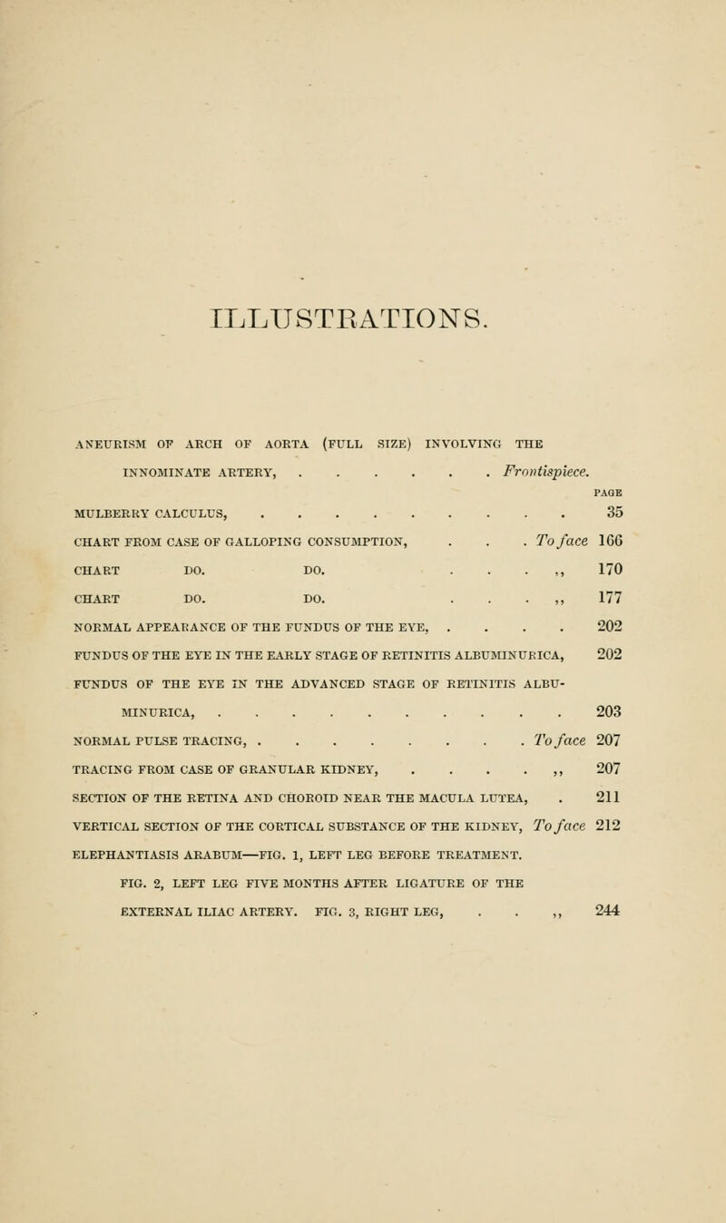 ILLUSTRATIONS, ANEURISM OP ARCH OF AORTA (PULL SIZE) INVOLVING THE INNOMINATE ARTERY Frontispiece. PAGE MULBERRY CALCULUS, 35 CHART FROM CASE OF GALLOPING CONSUMPTION, . . . To face 166 CHART DO. DO. . . . ,, 170 CHART DO. DO. . . . ,, 177 NORMAL APPEARANCE OF THE FUNDUS OF THE EYE, .... 202 FUNDUS OF THE EYE IN THE K\RLY STAGE OF RETINITIS ALBUMINUKICA, 202 FUNDUS OF THE EYE IN THE ADVANCED STAGE OF RETINITIS ALBU- MINURICA, 203 NORMAL PULSE TRACING, To faCC 207 TRACING FROM CASE OF GRANULAR KIDNEY, , 207 SECTION OF THE RETINA AND CHOROID NEAR THE MACULA LUTEA, . 211 VERTICAL SECTION OF THE CORTICAL SUBSTANCE OF THE KIDNEY, To face 212 ELEPHANTIASIS ARABUM—FIG. 1, LEFT LEG BEFORE TREATMENT. FIG. 2, LEFT LEG FIVE MONTHS AFTER LIGATURE OF THE EXTERNAL ILIAC ARTERY. FIG. 3, RIGHT LEG, . . ,, 244