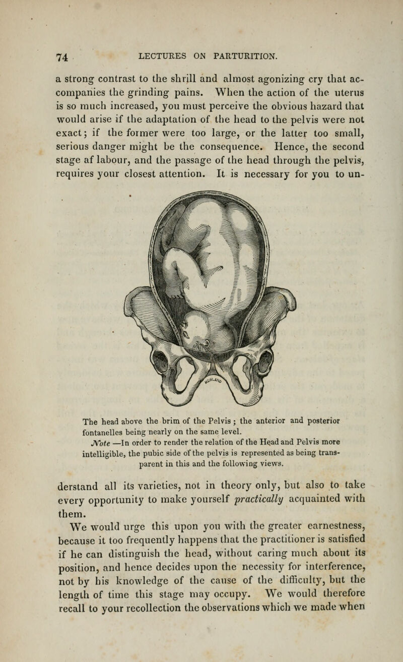 a Strong contrast to the shrill and almost agonizing cry that ac- companies the grinding pains. When the action of the uterus is so much increased, you must perceive the obvious hazard that would arise if the adaptation of the head to the pelvis were not exact; if the former were too large, or the latter too small, serious danger might be the consequence. Hence, the second stage af labour, and the passage of the head through the pelvis, requires your closest attention. It is necessary for you to un- The head above the brim of the Pelvis ; the anterior and posterior fontanelles being nearly on the same level. jSTote —In order to render the relation of the Head and Pelvis more intelligible, the pubic side of the pelvis is represented as being trans- parent in this and the following views. derstand all its varieties, not in theory only, but also to take every opportunity to make yourself practically acquainted with them. We would urge this upon you with the greater earnestness, because it too frequently happens that the practitioner is satisfied if he can distinguish the head, without caring much about its position, and hence decides upon the necessity for interference, not by his knowledge of the cause of the difficulty, but the length of time this stage may occupy. We would therefore recall to your recollection the observations which we made when