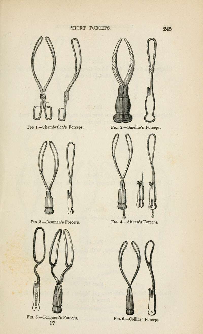 Fig 1.—Ghamberlen's Forceps. Fig. 3.—Denman's Forceps. Fig. 2.—Smellie's Forceps. Fig. 4.—Aitkea's Forceps. Fig. 5.—Conquest's Forceps. 17 Fig. 6.—Collins' Forceps.