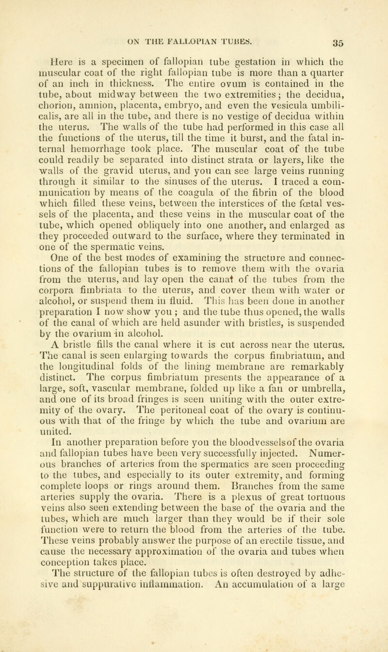 Here is a specimen of fallopian tube gestation in which the muscular coat of the right fallopian tube is more than a quarter of an inch in thickness. The entire ovum is contained in the tube, about midway between the two extremities; the decidua, chorion, amnion, placenta, embryo, and even the vesicula umbili- calis, are all in the tube, and there is no vestige of decidua within the uterus. The walls of the tube had performed in this case all the functions of the uterus, till the time it burst, and the fatal in- ternal hemorrhage took place. The muscular coat of the tube could readily be separated into distinct strata or layers, like the walls of the gravid uterus, and you can see large veins running through it similar to the sinuses of the uterus. I traced a com- munication by means of the coagula of the fibrin of the blood which filled these veins, between the interstices of the foetal ves- sels of the placenta, and these veins in the muscular coat of the tube, which opened obliquely into one another, and enlarged as they proceeded outward to the surface, where they terminated in one of the spermatic veins. One of the best modes of examining the structure and connec- tions of the fallopian tubes is to remove them with the ovaria from the uterus, and lay open the canat of the tubes from the corpora fimbriata to the uterus, and cover them with water or alcohol, or suspend them in fluid. This has been done in another preparation I now show you ; and the tube thus opened, the walls of the canal of which are held asunder with bristles, is suspended by the ovarium in alcohol. A bristle fills the canal where it is cut across near the uterus. The canal is seen enlarging towards the corpus fimbriatum, and the longitudinal folds of the lining membrane are remarkably distinct. The corpus fimbriatum presents the appearance of a large, soft, vascular membrane, folded up like a fan or umbrella, and one of its broad fringes is seen uniting with the outer extre- mity of the ovary. The peritoneal coat of the ovary is continu- ous with that of the fringe by which the tube and ovarium are united. In another preparation before you the bloodvessels of the ovaria and fallopian tubes have been very successfully injected. Numer- ous branches of arteries from the spermatics are seen proceeding to the tubes, and especially to its outer extremity, and forming complete loops or rings around them. Branches from the same arteries supply the ovaria. There is a plexus of great tortuous veins also seen extending between the base of the ovaria and the tubes, which are much larger than they would be if their sole function were to return the blood from the arteries of the tube. These veins probably answer the purpose of an erectile tissue, and cause the necessary approximation of the ovaria and tubes when conception takes place. The structure of the fallopian tubes is often destroyed by adhe- sive and suppurative inflammation. An accumulation of a large