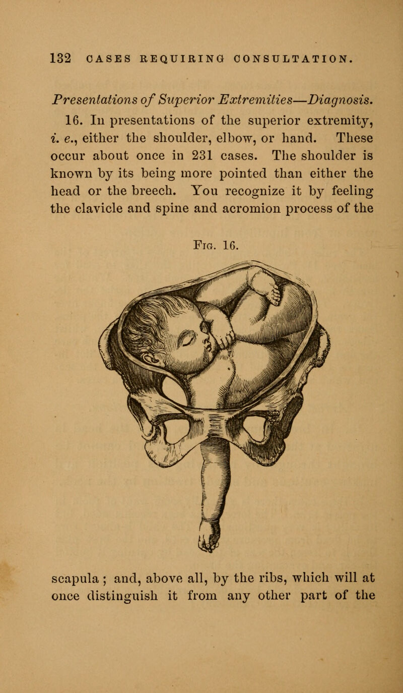 Presentations of Superior Extremities—Diagnosis, 16. In presentations of the superior extremity, i. e., either the shoulder, elbow, or hand. These occur about once in 231 cases. The shoulder is known by its being more pointed than either the head or the breech. You recognize it by feeling the clavicle and spine and acromion process of the Fiox. 16. scapula; and, above all, by the ribs, which will at once distinguish it from any other part of the