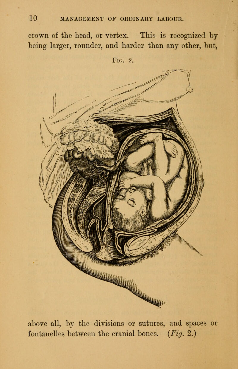 crown of the head, or vertex. This is recognized by being larger, rounder, and harder than any other, but, Fio. 2. above all, by the divisions or sutures, and spaces or fontanelles between the cranial bones. {Fig. 2.)