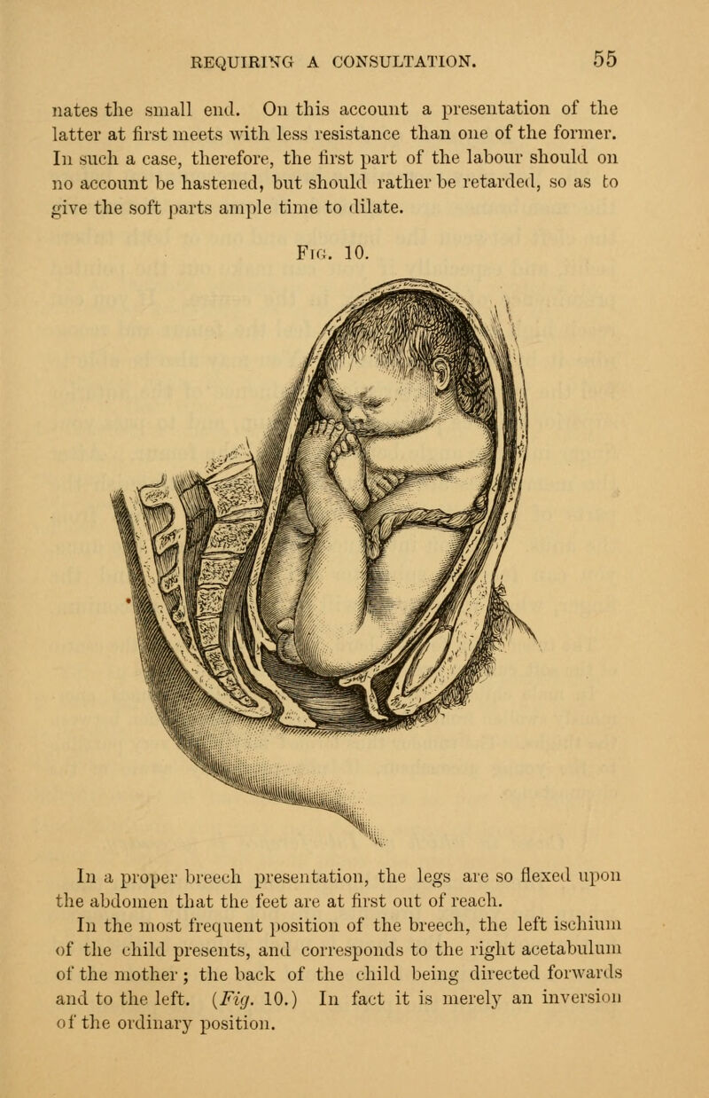 nates tlie small end. On this account a presentation of the latter at first meets with less resistance than one of the former. In such a case, therefore, the first part of the labour should on no account be hastened, but should rather be retarded, so as to give the soft parts am]ile time to dilate. Fio. 10. In a proper breech presentation, the legs are so flexed upon the abdomen that the feet are at first out of reach. In the most frequent jtosition of the breech, the left ischium of the child presents, and corresponds to the right acetabulum of the mother; the back of the child being directed forwards and to the left. [Fig. 10.) In fact it is merely an inversion of the ordinary position.