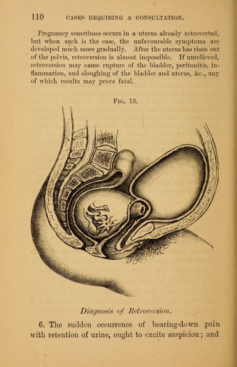 Pregnancy sometimes occiii's in a uterus already retroverted, but when sucli is the case, the unfavourable symptoms are developed much more gradually. After the uterus has risen out of the pelvis, retroversion is almost impossible. If unrelieved, retroversion may cause rupture of the bladder, peritonitis, in- flammation, and sloughing of the bladder and uterus, kc, any of which results may prove fatal. Fig. 13. Diarpiosis of Ret rare rsion. 6. The sudden occurrence of bearing-down pain ■with retention of urine, ought to excite suspicion; and