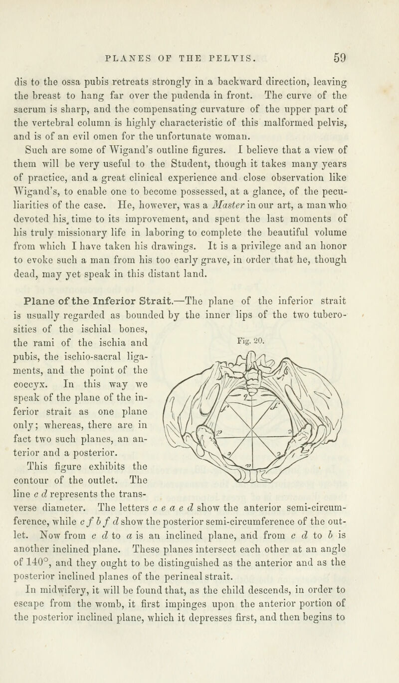 dis to the ossa pubis retreats strongly in a backward direction, leaving the breast to hang far over the pudenda in front. The curve of the sacrum is sharp, and the compensating curvature of the upper part of the vertebral column is highly characteristic of this malformed pelvis, and is of an evil omen for the unfortunate woman. Such are some of Wigand's outline figures. I believe that a view of them will be very useful to the Student, though it takes many years of practice, and a great clinical experience and close observation like Wigand's, to enable one to become possessed, at a glance, of the pecu- liarities of the case. He, however, was a Master in our art, a man who devoted his, time to its improvement, and spent the last moments of his truly missionary life in laboring to complete the beautiful volume from which I have taken his drawings. It is a privilege and an honor to evoke such a man from his too early grave, in order that he, though dead, may yet speak in this distant land. Plane of the Inferior Strait.—The plane of the inferior strait is usually regarded as bounded by the inner lips of the two tubero- sities of the ischial bones, the rami of the ischia and ^^g- ^0- pubis, the ischio-sacral liga- ments, and the point of the coccyx. In this way we speak of the plane of the in- ferior strait as one plane only; whereas, there are in fact two such planes, an an- terior and a posterior. This figure exhibits the contour of the outlet. The line c d represents the trans- verse diameter. The letters c e a e d show the anterior serai-circum- ference, while c f h f d show the posterior semi-circumference of the out- let. Now from c d io a is an inclined plane, and from c t^ to 5 is another inclined plane. These planes intersect each other at an angle of 140°, and they ought to be distinguished as the anterior and as the posterior inclined planes of the perineal strait. In midwifery, it will be found that, as the child descends, in order to escape from the womb, it first impinges upon the anterior portion of the posterior inclined plane, which it depresses first, and then begins to