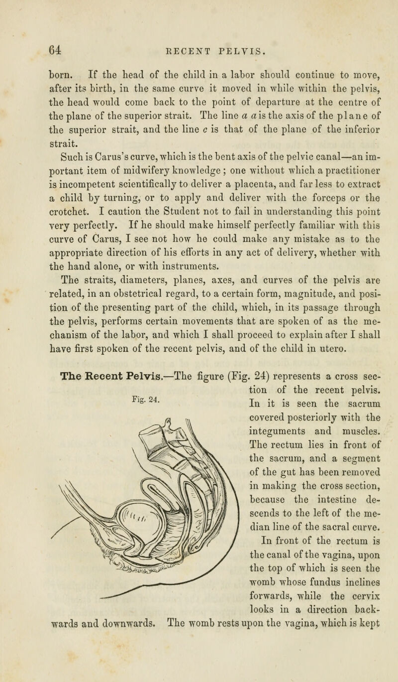 born. If the head of the child in a labor should continue to move, after its birth, in the same curve it moved in while within the pelvis, the head would come back to the point of departure at the centre of the plane of the superior strait. The line a a is the axis of the plane of the superior strait, and the line c is that of the plane of the inferior strait. Such is Carus's curve, which is the bent axis of the pelvic canal—an im- portant item of midwifery knowledge ; one without which a practitioner is incompetent scientifically to deliver a placenta, and far less to extract a child by turning, or to apply and deliver with the forceps or the crotchet. I caution the Student not to fail in understanding this point very perfectly. If he should make himself perfectly familiar with this curve of Carus, I see not how he could make any mistake as to the appropriate direction of his efforts in any act of delivery, whether with the hand alone, or with instruments. The straits, diameters, planes, axes, and curves of the pelvis are related, in an obstetrical regard, to a certain form, magnitude, and posi- tion of the presenting part of the child, which, in its passage through the pelvis, performs certain movements that are spoken of as the me- chanism of the labor, and which I shall proceed to explain after I shall have first spoken of the recent pelvis, and of the child in utero. The Recent Pelvis.- Fig. 24. wards and downwards. The figure (Fig. 24) represents a cross sec- tion of the recent pelvis. In it is seen the sacrum covered posteriorly with the integuments and muscles. The rectum lies in front of the sacrum, and a segment of the gut has been removed in making the cross section, because the intestine de- scends to the left of the me- dian line of the sacral curve. In front of the rectum is the canal of the vagina, upon the top of which is seen the womb whose fundus inclines forwards, while the cervix looks in a direction back- The womb rests upon the vagina, which is kept