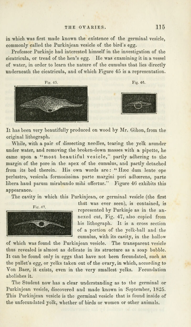 in which was first made known the existence of the germinal vesicle, commonly called the Purkinjean vesicle of the bird's egg. Professor Purkinje had interested himself in the investigation of the cicatricula, or tread of the hen's egg. He was examining it in a vessel of water, in order to learn the nature of the cumulus that lies directly underneath the cicatricula, and of which Figure 45 is a representation. Fi2. 45. Fig. 46. 47. It has been very beautifully produced on wood by Mr. Gihon, from the original lithograph. While, with a pair of dissecting needles, tearing the yelk asunder under water, and removing the broken-down masses with a pipette, he came upon a most beautiful vesicle, partly adhering to the margin of the pore in the apex of the cumulus, and partly detached from its bed therein. His own words are:  Hsec dum lente ope perlustro, vesicula formosissiina parte margin! pori adhgerens, parte libera baud parum mirabundo mihi offertur. Figure 46 exhibits this appearance. The cavity in which this Purkinjean, or germinal vesicle (the first thst was ever seen), is contained, is represented by Purkinje as in the an- nexed cut, Fig. 47, also copied from his lithograph. It is a cross section of a portion of the yelk-ball and the cumulus, with its cavity, in the hollow of which was found the Purkinjean vesicle. The transparent vesicle thus revealed is almost as delicate in its structure as a soap bubble. It can be found only in eggs that have not been fecundated, such as the pullet's egg, or yelks taken out of the ovary, in which, according to Von Baer, it exists, even in the very smallest yelks. Fecundation abolishes it. The Student now has a clear understanding as to the germinal or Purkinjean vesicle, discovered and made known in September, 1825. This Purkinjean vesicle is the germinal vesicle that is found inside of the unfecundated yolk, whether of birds or women or other animals. ^^^^^^^^^^^^^^^^^^^^^^^^.