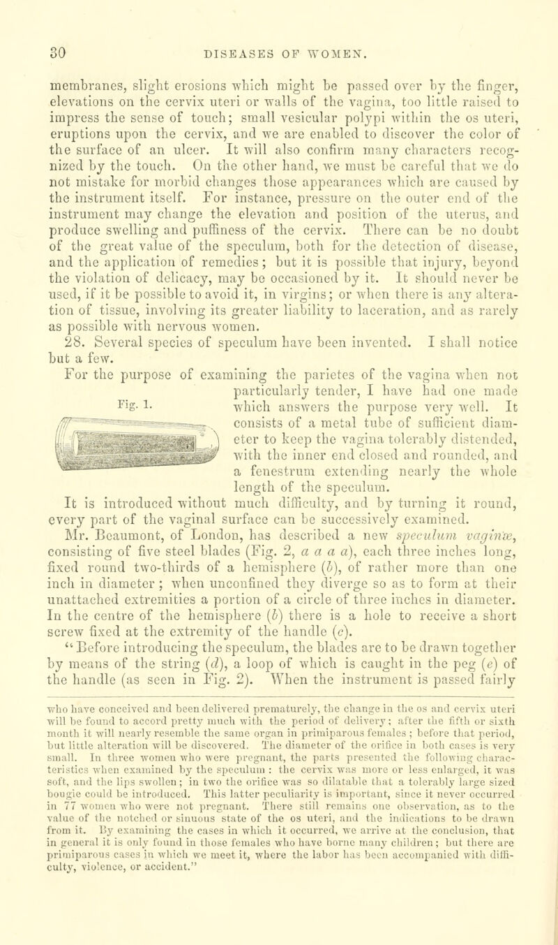 membranes, slight erosions which might he passed over by the finger, elevations on the cervix uteri or walls of the vagina, too little raised to impress the sense of touch; small vesicular polypi within the os uteri, eruptions upon the cervix, and we are enabled to discover the color of the surface of an ulcer. It will also confirm many characters recog- nized by the touch. On the other hand, we must be careful that we do not mistake for morbid changes those appearances which are caused by the instrument itself. For instance, pressure on the outer end of the instrument may change the elevation and position of the uterus, and produce swelling and puffiness of the cervix. There can be no doubt of the great value of the speculum, both for the detection of disease, and the application of remedies ; but it is possible that injury, beyond the violation of delicacy, may be occasioned by it. It should never be used, if it be possible to avoid it, in virgins; or when there is any altera- tion of tissue, involving its greater liability to laceration, and as rarely as possible with nervous women. 28. Several species of speculum have been invented. I shall notice but a few. For the purpose of examining the parietes of the vagina when not particularly tender, I have had one made which answers the purpose very well. It consists of a metal tube of sufficient diam- eter to keep the vagina tolerably distended, with the inner end closed and rounded, and  ■''- ^ fenestrum extending nearly the whole length of the speculum. It is introduced without much difficulty, and by turning it round, every part of the vaginal surface can be successively examined. Mr. Beaumont, of London, has described a new speculum vagw'w, consisting of five steel blades (Fig. 2, a a a a), each three inches long, fixed round two-thirds of a hemisphere (5), of rather more than one inch in diameter; when unconfined they diverge so as to form at their unattached extremities a portion of a circle of three inches in diameter. In the centre of the hemisphere [b) there is a hole to receive a short screw fixed at the extremity of the handle (c).  Before introducing the speculum, the blades are to be drawn together by means of the string (d), a loop of which is caught in the peg (e) of the handle (as seen in Fig. 2). When the instrument is passed fairly who have conceived and been delivered prematurely, the change in the os and cervix uteri ■will be found to accord pretty much with the period of delivery; after the fifth or sixth month it will nearly resemble the same organ in primiparous females ; before that period, but little alteration will be discovered. The diameter of the orifice in both cases is very small. In three women who were pregnant, the parts presented the followmg charac- teristics when examined by the speculum : the cervix was more or less enlarged, it was soft, and the lips swollen; in two the orifice was so dilatable that a tolerably large sized bougie could be introduced. This latter peculiai-ity is important, since it never occui-red in 77 women who were not pregnant. There still remains one observation, as to the value of the notched or sinuous state of the os uteri, and the indications to be drawn from it. By examining the cases in which it occurred, we arrive at the conclusion, that in general it is only found in those females who have borne many children; but there are priniiparous cases in which wo meet it, where the labor has been accompanied with difli- culty, violence, or accident.