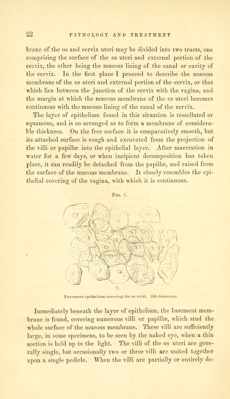 brane of the os and cervix uteri may be divided into two tracts, one comprising the surface of the os uteri and external portion of the cervix, the other being the mucous lining of the canal or cavity of the cervix. In the first place I proceed to describe the mucous membrane of the os uteri and external portion of the cervix, or that which lies between the junction of the cervix with the vagina, and the margin at which the mucous membrane of the os uteri becomes continuous with the mucous lining of the canal of the cervix. The layer of epithelium found in this situation is tessellated or squamous, and is so arranged as to form a membrane of considera- ble thickness. On the free surface it is comparatively smooth, but its attached surface is rough and excavated from the projection of the villi or papillae into the epithelial layer. After maceration in water for a few days, or when incipient decomposition has taken place, it can readily be detached from the papillae, and raised from the surface of the mucous membrane. It closely resembles the epi- thelial covering of the vagina, with which it is continuous. Fig. 1. Pavement epithelium covering; the os uleri. 240 diameters. Immediately beneath the layer of epithelium, the basement mem- brane is found, covering numerous villi or papillae, which stud the whole surface of the mucous membrane. These villi are sufficiently large, in some specimens, to be seen by the naked eye, when a thin section is held up to the light. The villi of the os uteri are gene- rally single, but occasionally two or three villi are united together upon a single pedicle. When the villi are partially or entirely de-