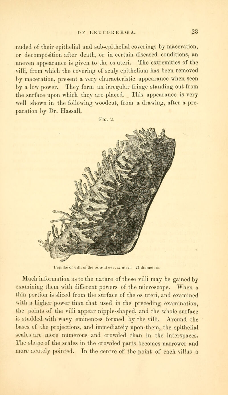 nuded of their epithelial and sub-epithelial coverings by maceration, or decomposition after death, or in certain diseased conditions, an uneven appearance is given to the os uteri. The extremities of the villi, from which the covering of scaly epithelium has been removed by maceration, present a very characteristic appearance when seen by a low power. They form an irregular fringe standing out from the surface upon which they are placed. This appearance is very well shown in the following woodcut, from a drawing, after a pre- paration by Dr. Hassall. Fig. 2. Papilla; or villi of the os and cervix uteri. 24 diameters. Much information as to the nature of these villi may be gained by examining them with different powers of the microscope. When a thin portion is sliced from the surface of the os uteri, and examined with a higher power than that used in the preceding examination, the points of the villi appear nipple-shaped, and the whole surface is studded with wavy eminences formed by the villi. Around the bases of the projections, and immediately upon them, the epithelial scales are more numerous and crowded than in the interspaces. The shape of the scales in the crowded parts becomes narrower and more acutely pointed. In the centre of the point of each villus a